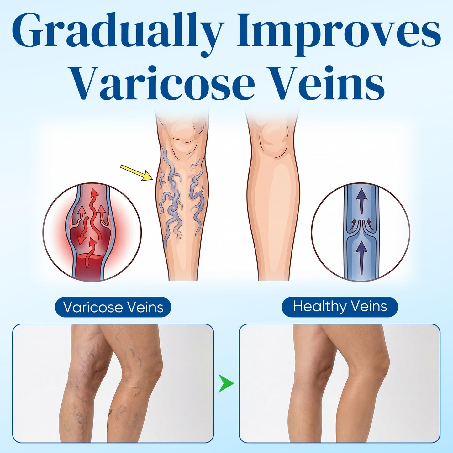 2Box Vein Target Microdarts Patch, Professional Varicose Veins Treatment for Legs, Improves Blood Circulation, Natural Ingredients Varicose Vein Patches for All Skin Types