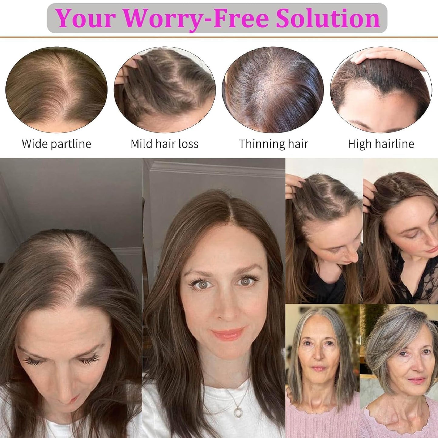 Human Hair Toppers for Women - Medium Brown with Warm Blonde Highlights | 10cm x 12cm