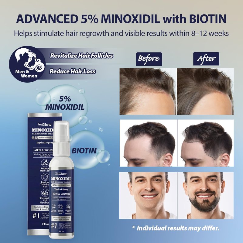 TruGlow 5% Minoxidil Hair Regrowth Treatment Spray - Unscented Scalp Solution for Thinning Hair | 2 oz