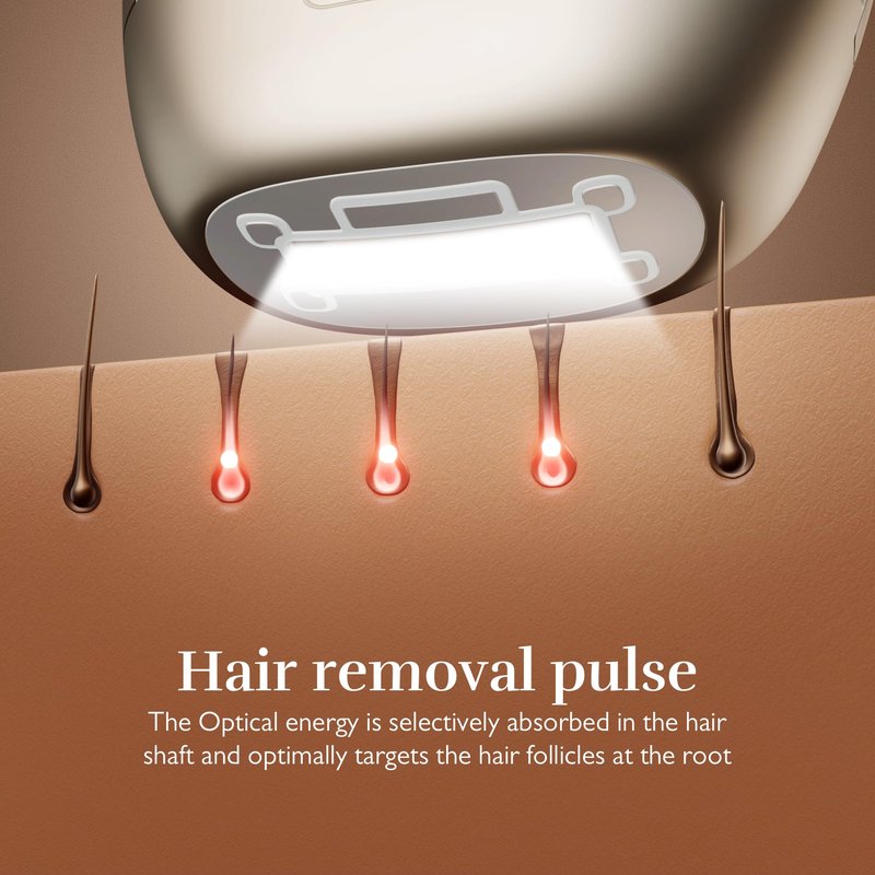 Silk'n 7 IPL Hair Removal Device for Women and Men, FDA-Cleared Permanent Hair Reduction at Home, 360° Rotating Head, Galvanic + IPL Technology, 3 Smart Attachments, Skin Tone Sensor, Painless, Gold