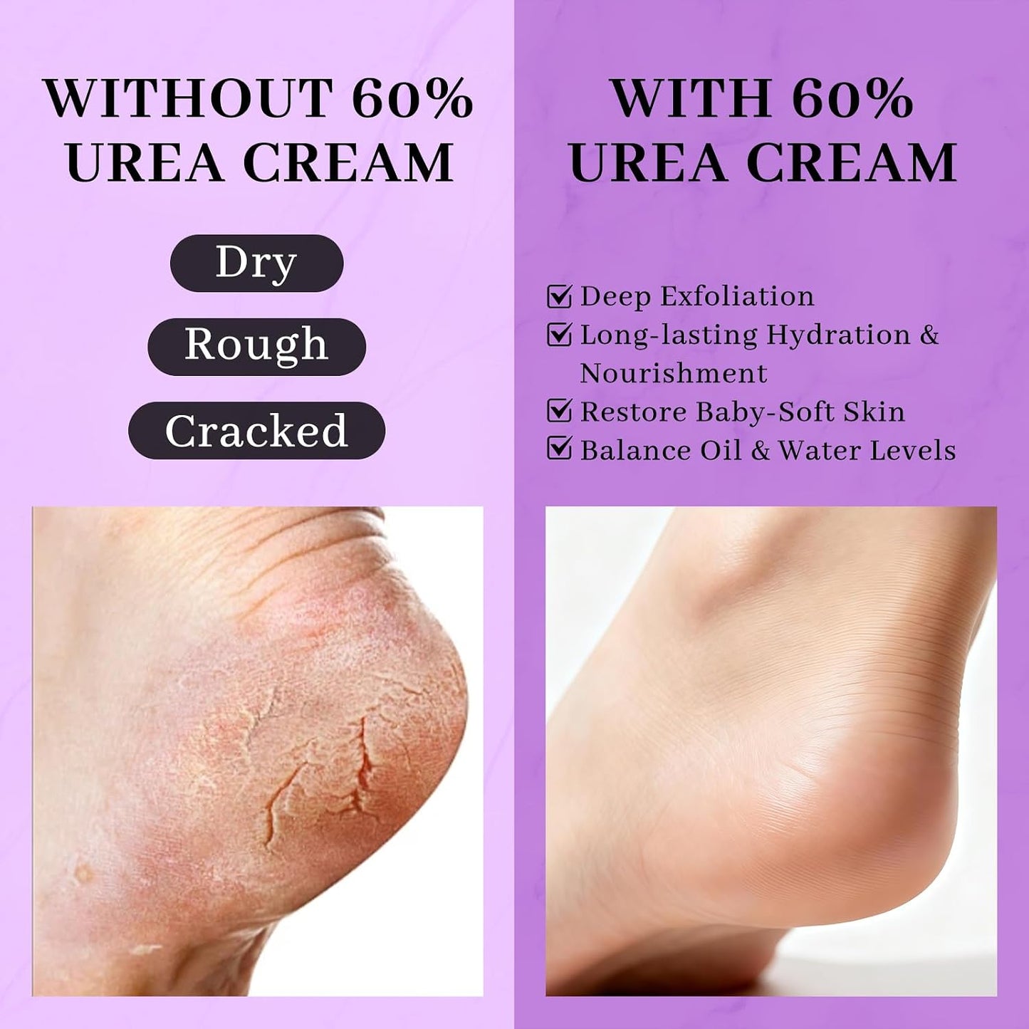 5-in-1 Urea Cream 60% with 2% Salicylic Acid - Maximum Strength Moisturizer for Rough, Dry Skin | 150g