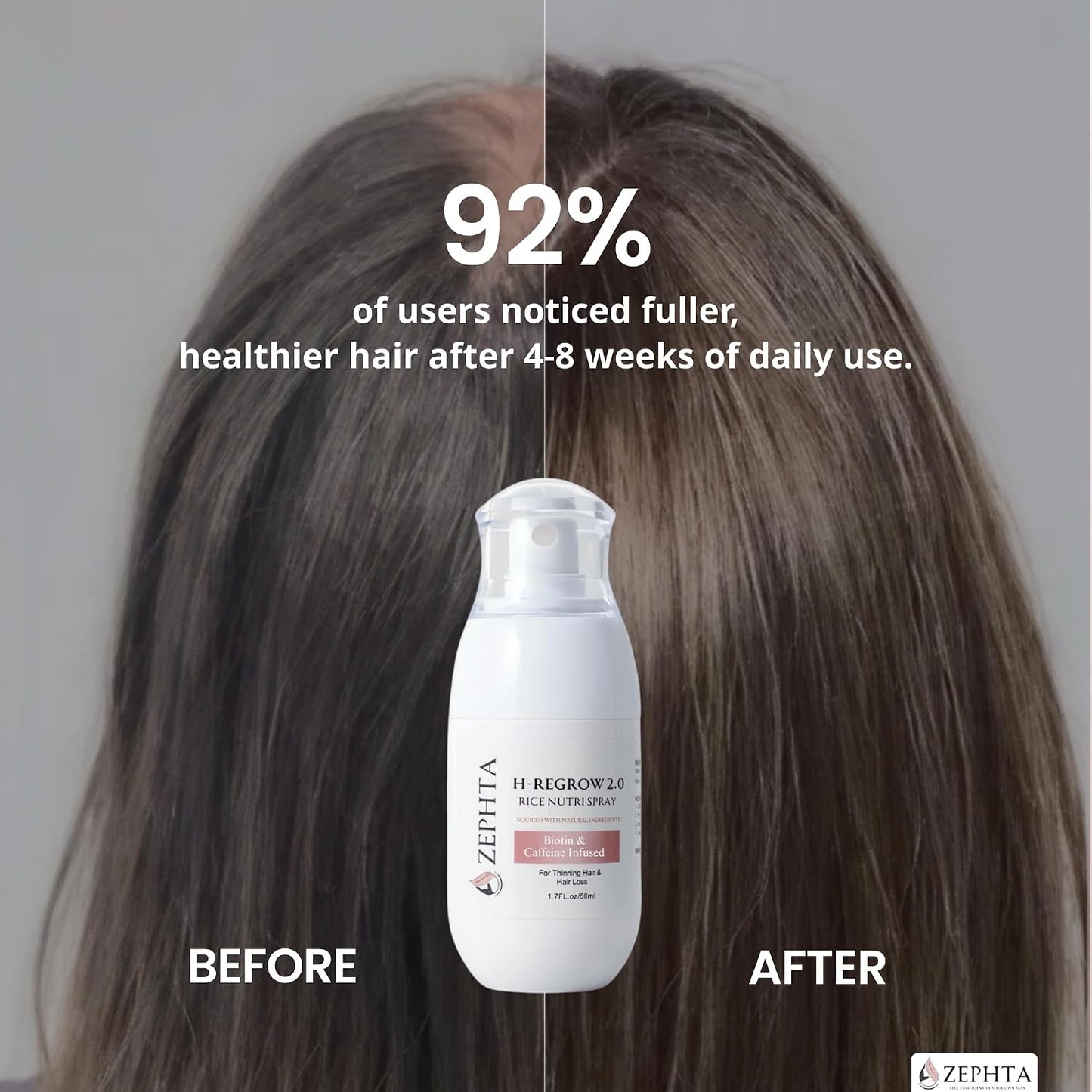 Zephta Hair Growth Spray - Rice Water, Biotin & Aloe Vera Formula for Thinning Hair | Unisex Solution