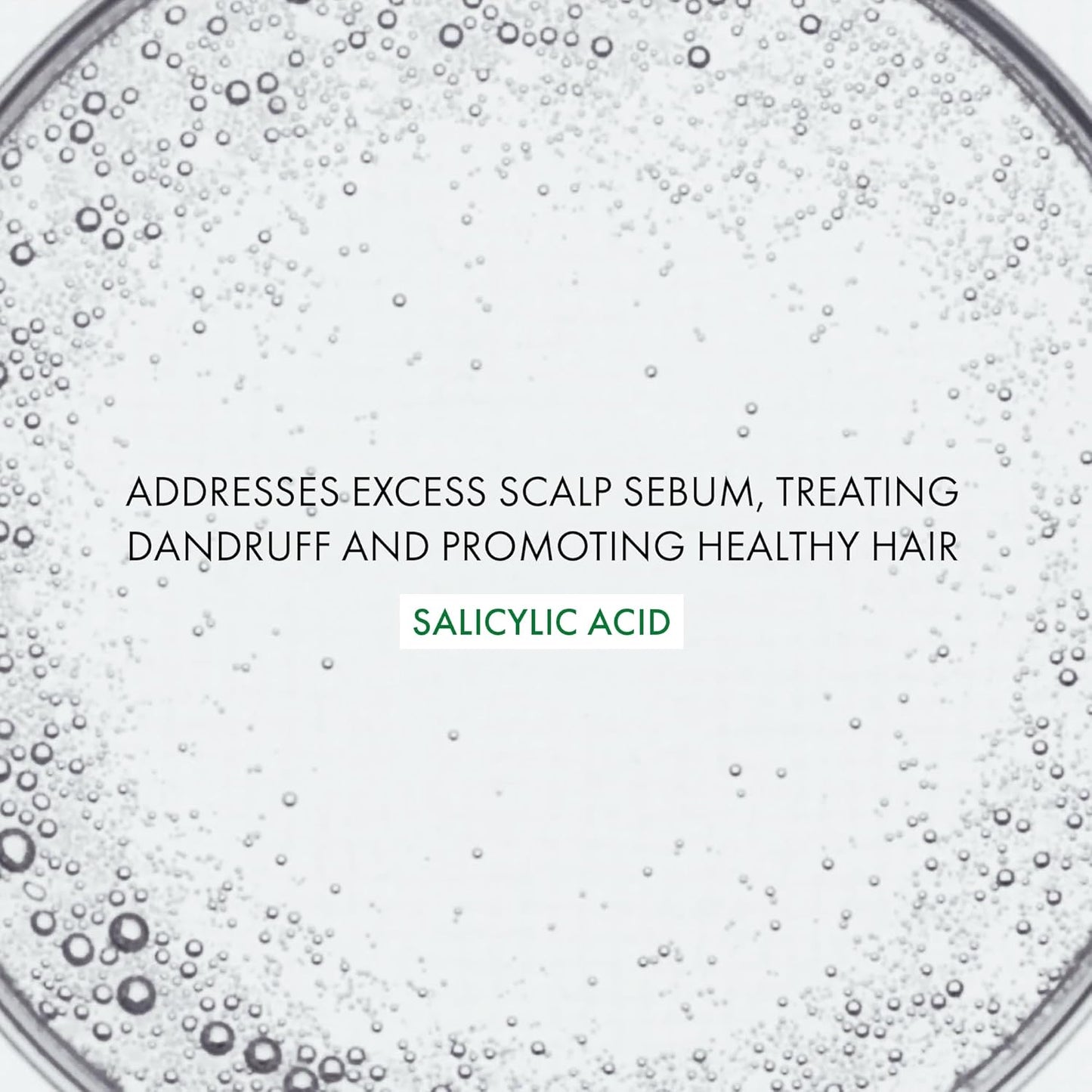 Vichy Dercos Salicylic Acid Anti-Dandruff Scalp Treatment - Flake & Itch Relief Serum, 3 Fl. Oz.