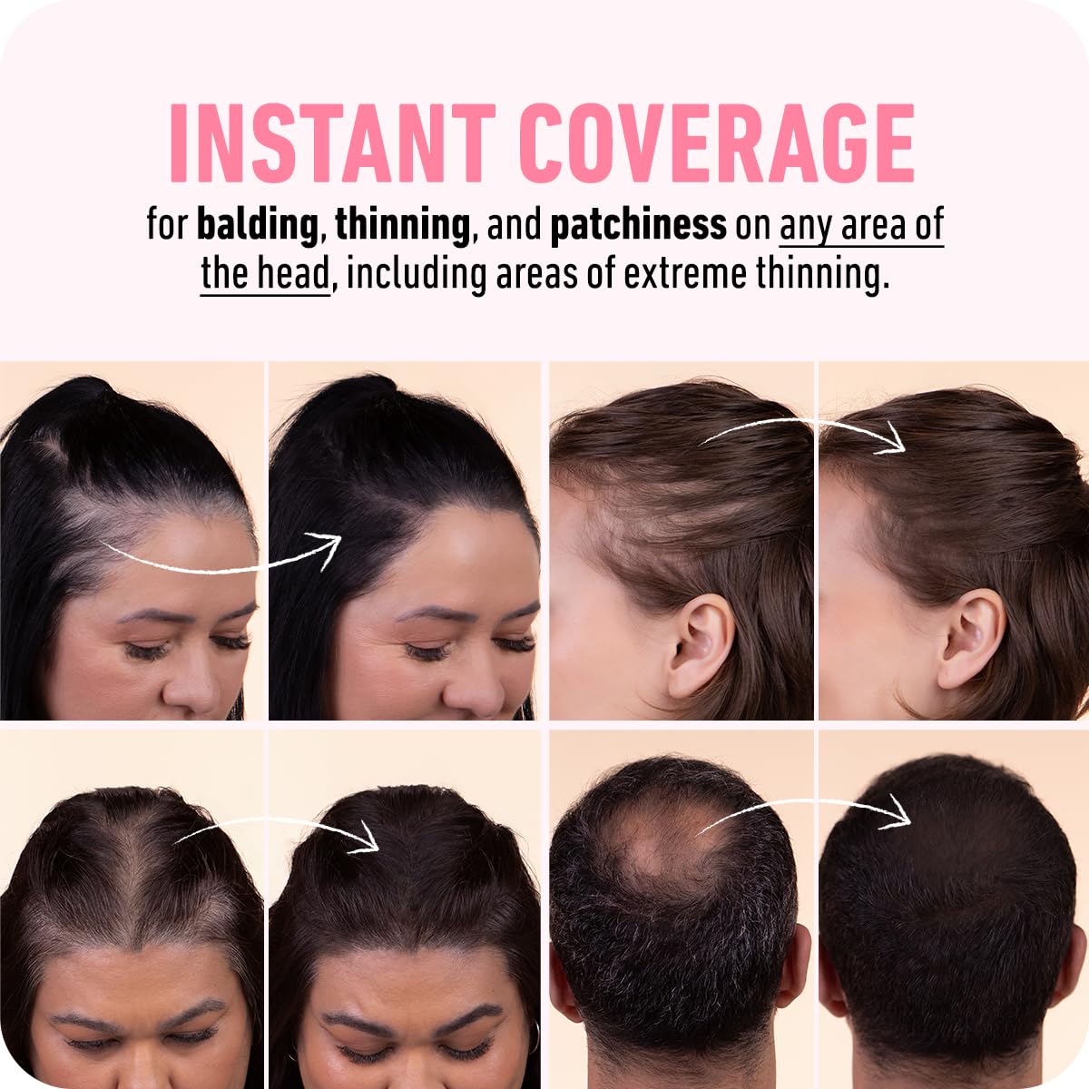 BOLDIFY Hairline Powder - Water-Resistant Root Touch-Up for Gray Coverage | Medium Brown, 24-Hour Stain-Proof