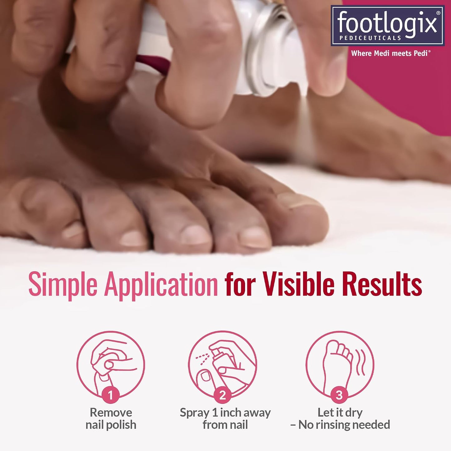 FOOTLOGIX Nail Tincture Spray - Spiraleen Formula for Healthy Nails | 1.55 Fl Oz