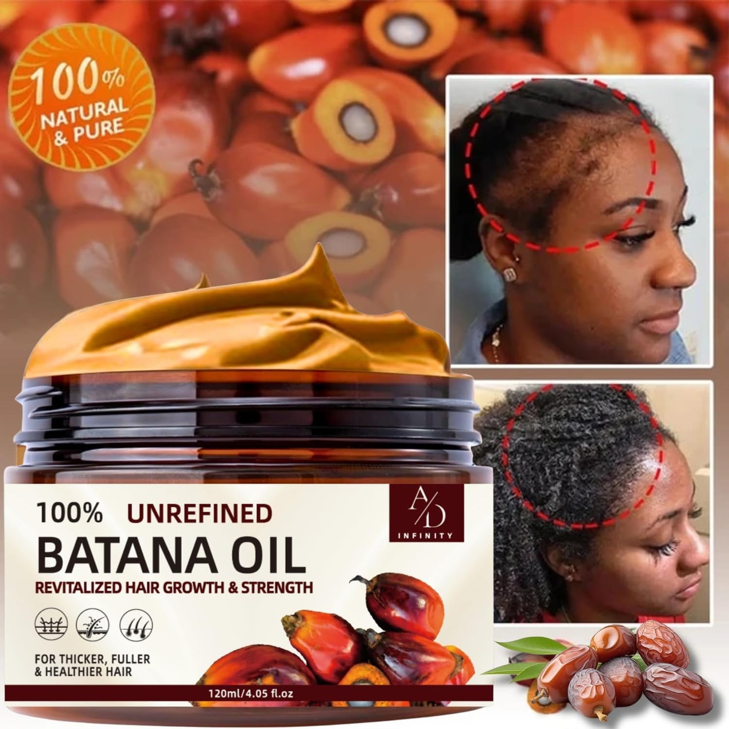Raw Batana Oil for Hair Growth - Organic Pure Formula with Keratin & Coffee Extract | 4oz