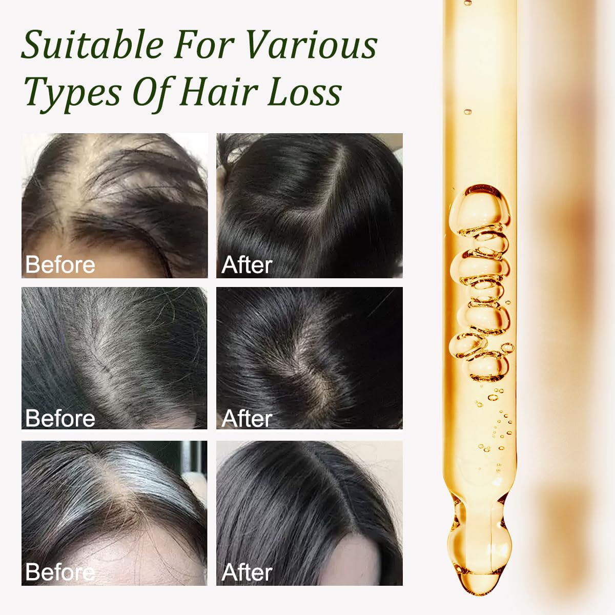 Gypsophila Batana Oil for Hair Growth -100% Pure Natural Hair Growth Oil,Nourishes The Scalp, Eliminates Split Ends, Reduce Hair Loss & Detox Your Scalp (1 Fl Oz) for All Hair Types