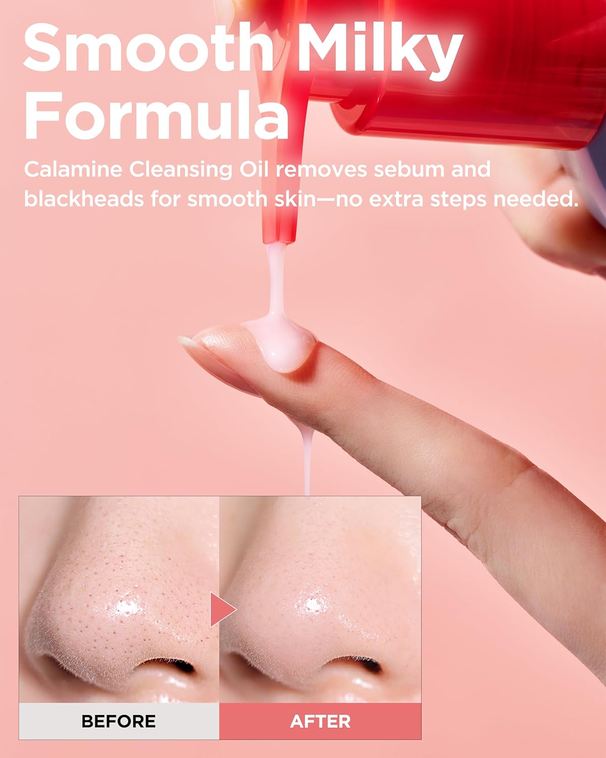 Calamine Pore Control Cleansing Oil - Deep Cleansing for Blackheads | 200ml / 6.76 fl oz