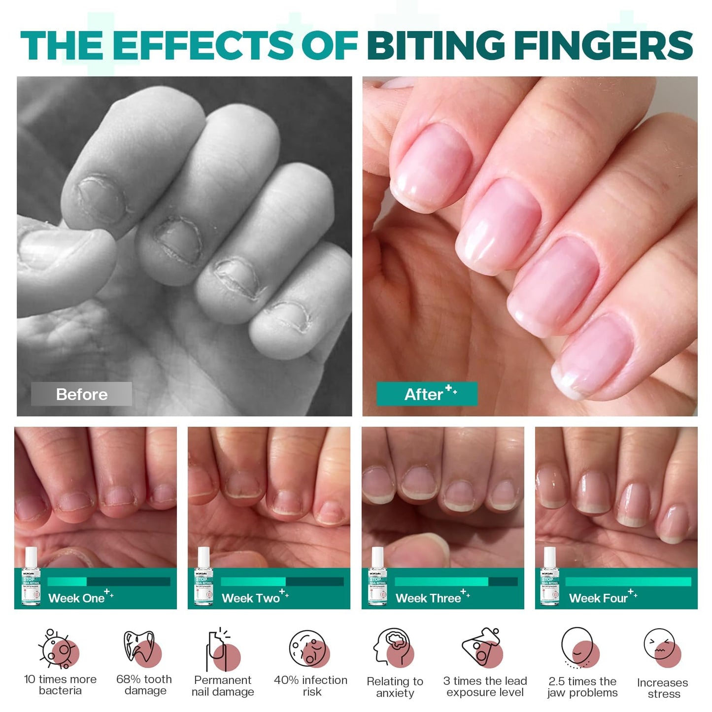 Morovan Nail Biting Prevention For Kids: Thumb Sucking Deterrent No Bite Nail Polish for Biters Anti Finger Sucking Lasting & Safe with Repair & Growth Nails 15ML Treatment Adults & Kids