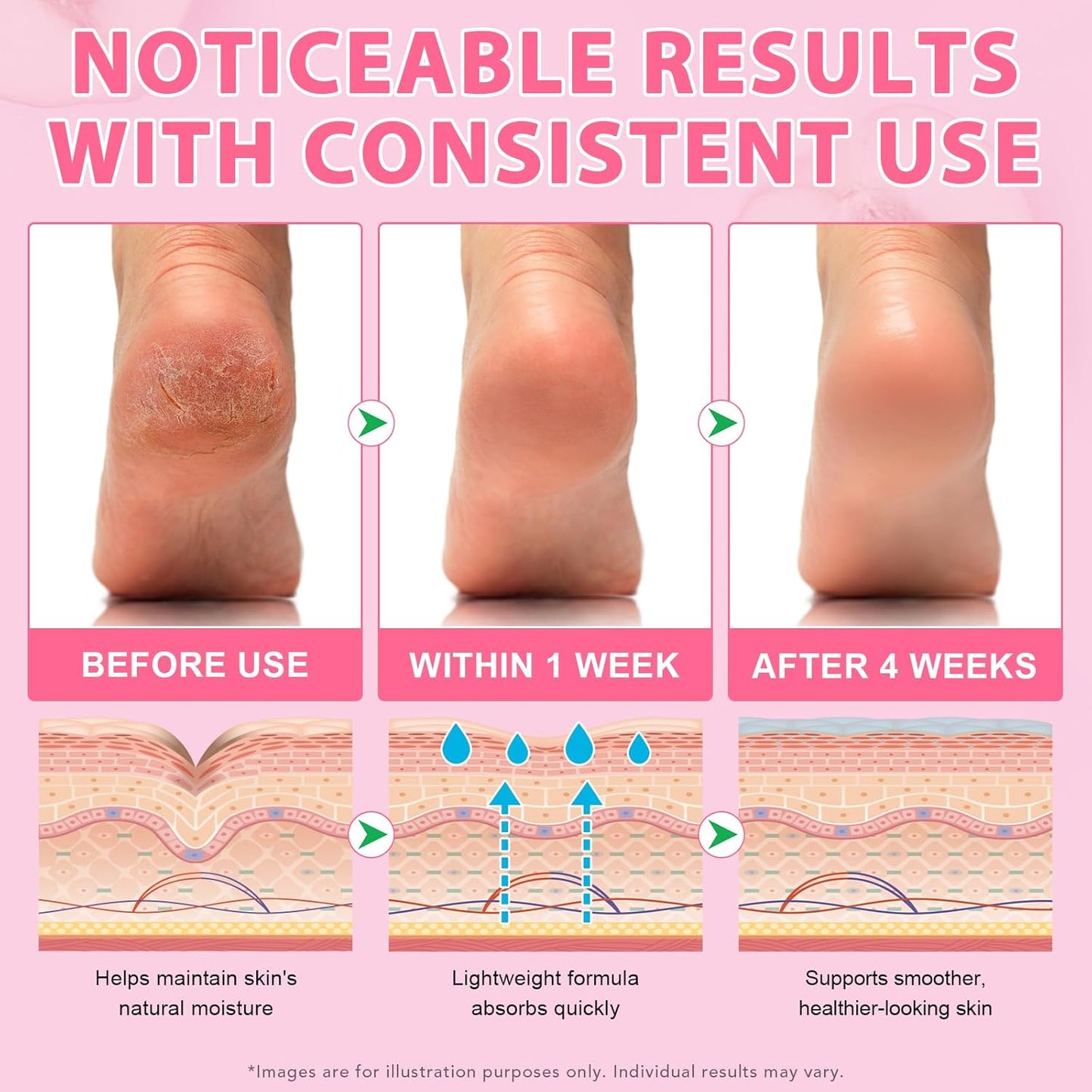 Urea Cream 60% & Salicylic Acid 2% Foot Repair Balm Stick - Intensive Moisturization & Callus Removal | Peach Scent | 1.41 Oz