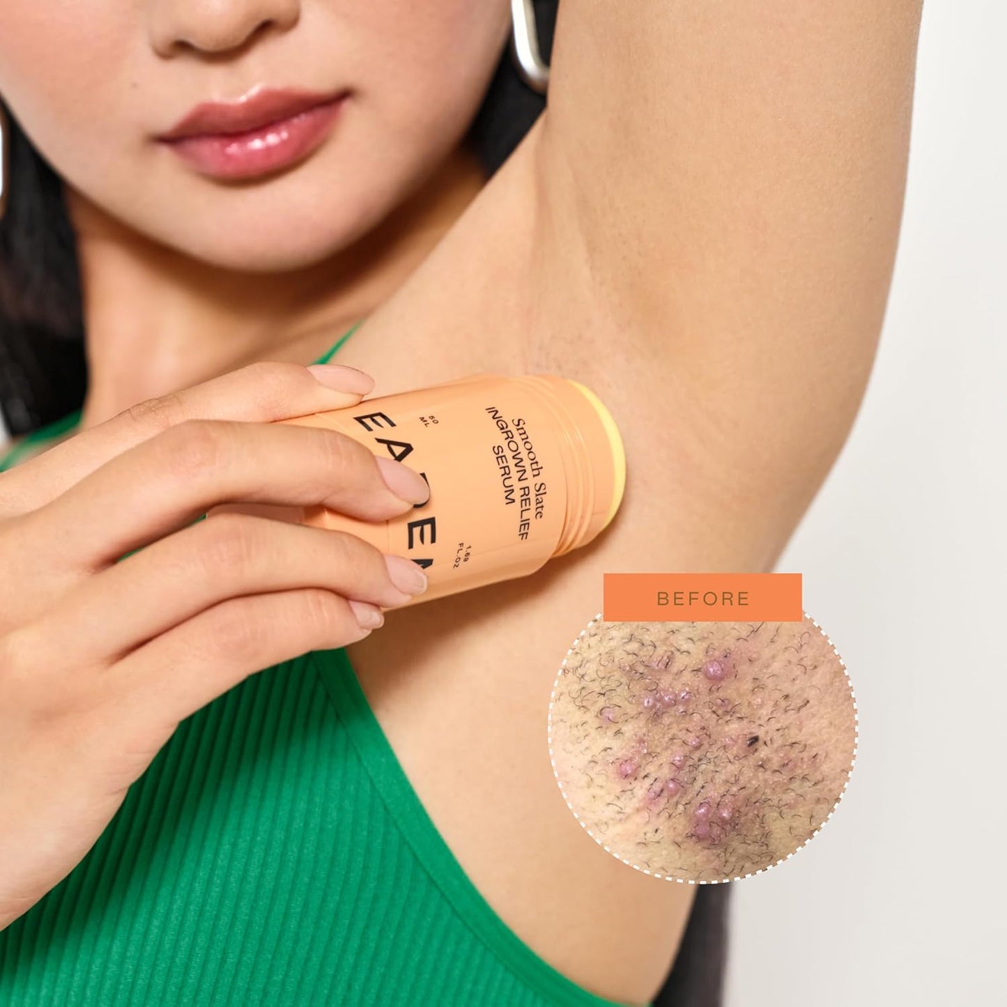 Eadem Smooth Slate Ingrown Hair Roller Serum - Targets Bumps & Faded Scars | AHAs for Dark Spots