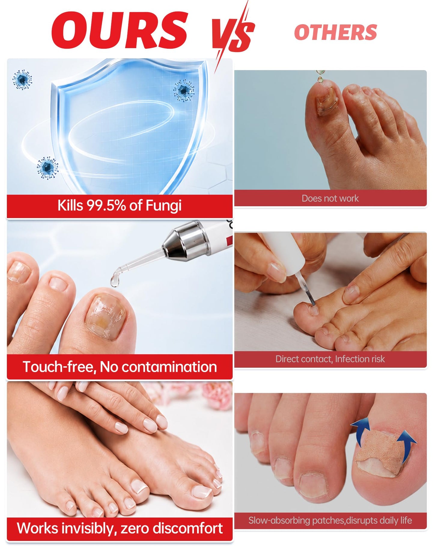 Toenail Fungus Treatment Extra Strength - 1% Tolnaftate & Triple Acid Complex - Repairs Thick, Yellow, Discolored & Damaged Nails - Fast-Acting Fungal Nail Treatment - 0.51 fl oz