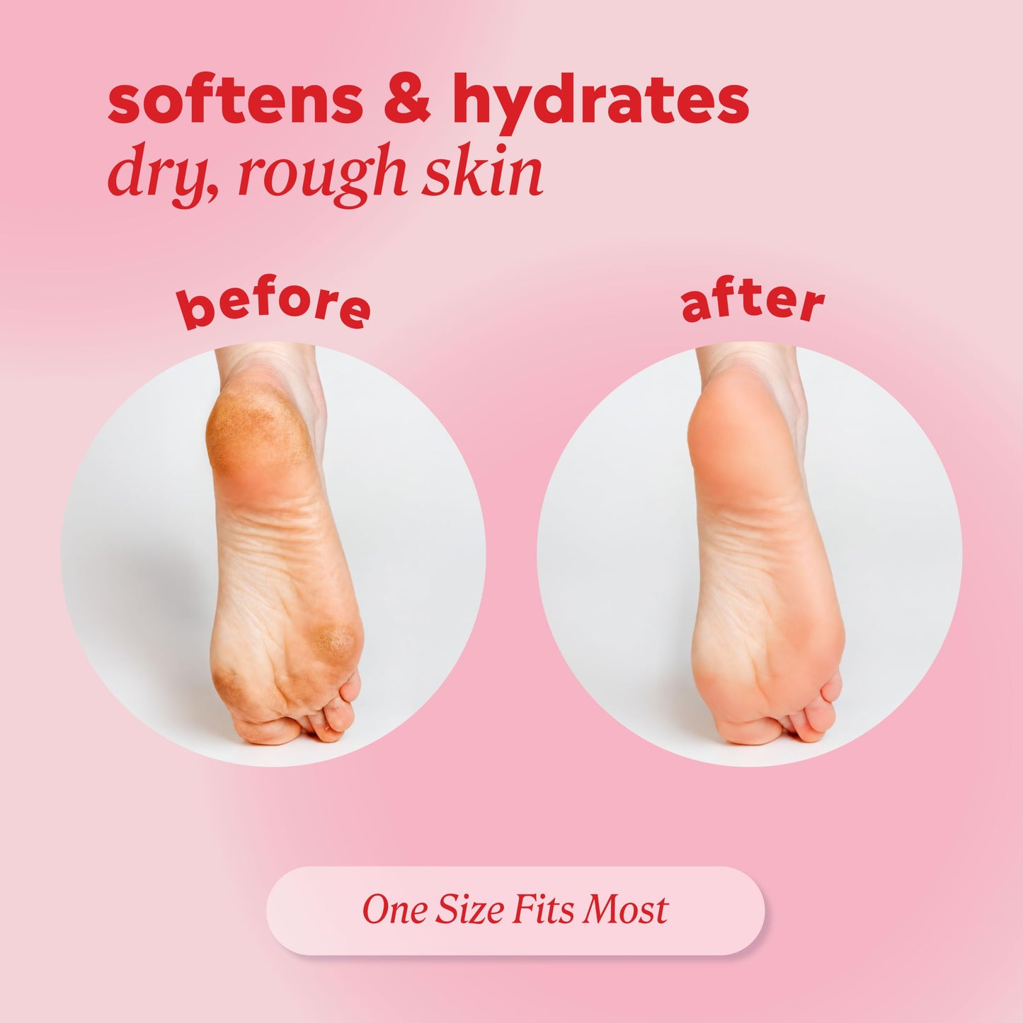 Onyx Professional Gel Moisturizing Socks, One Size Dry Feet Treatment for Women or Men, Hydrating Spa Socks for Dry Feet and Cracked Heel Repair, One Reusable Pair