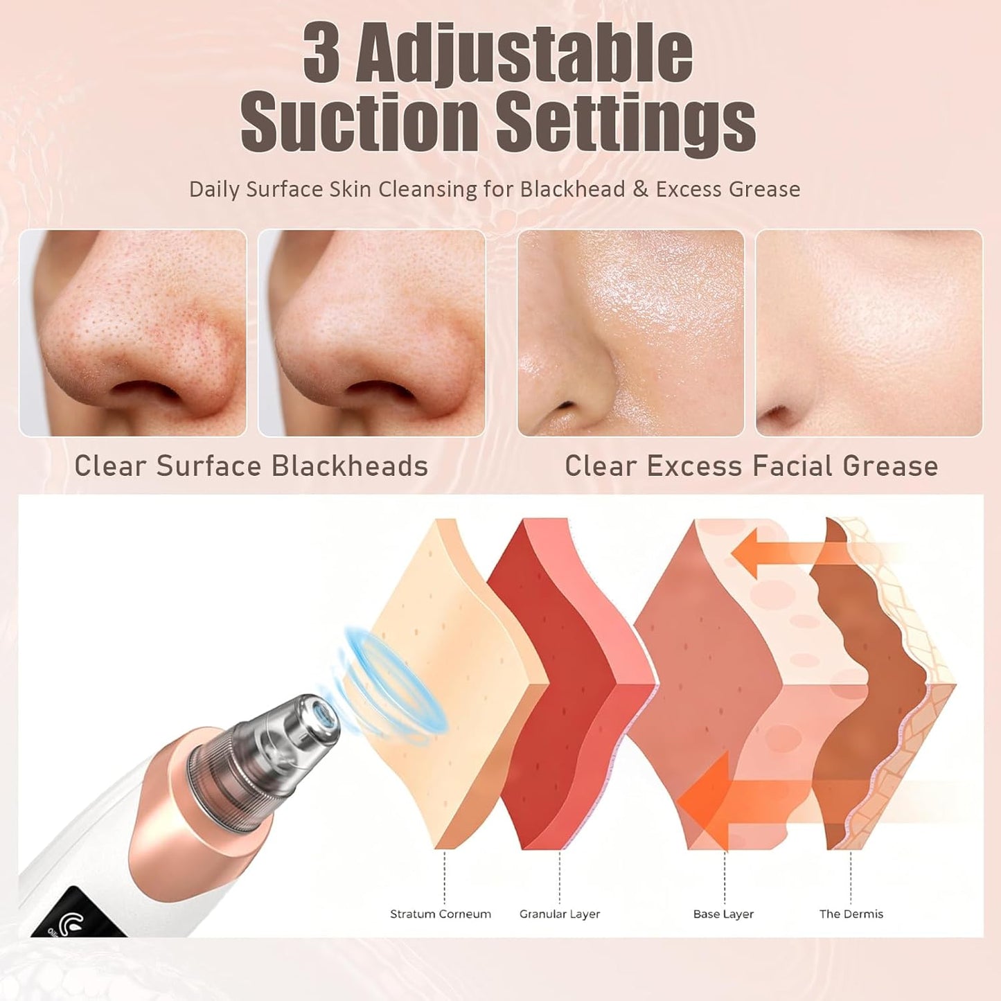 Blackhead Remover Pore Vacuum - USB Rechargeable Facial Cleaner with 5 Suction Levels & Probes | Effective Acne Treatment Tool