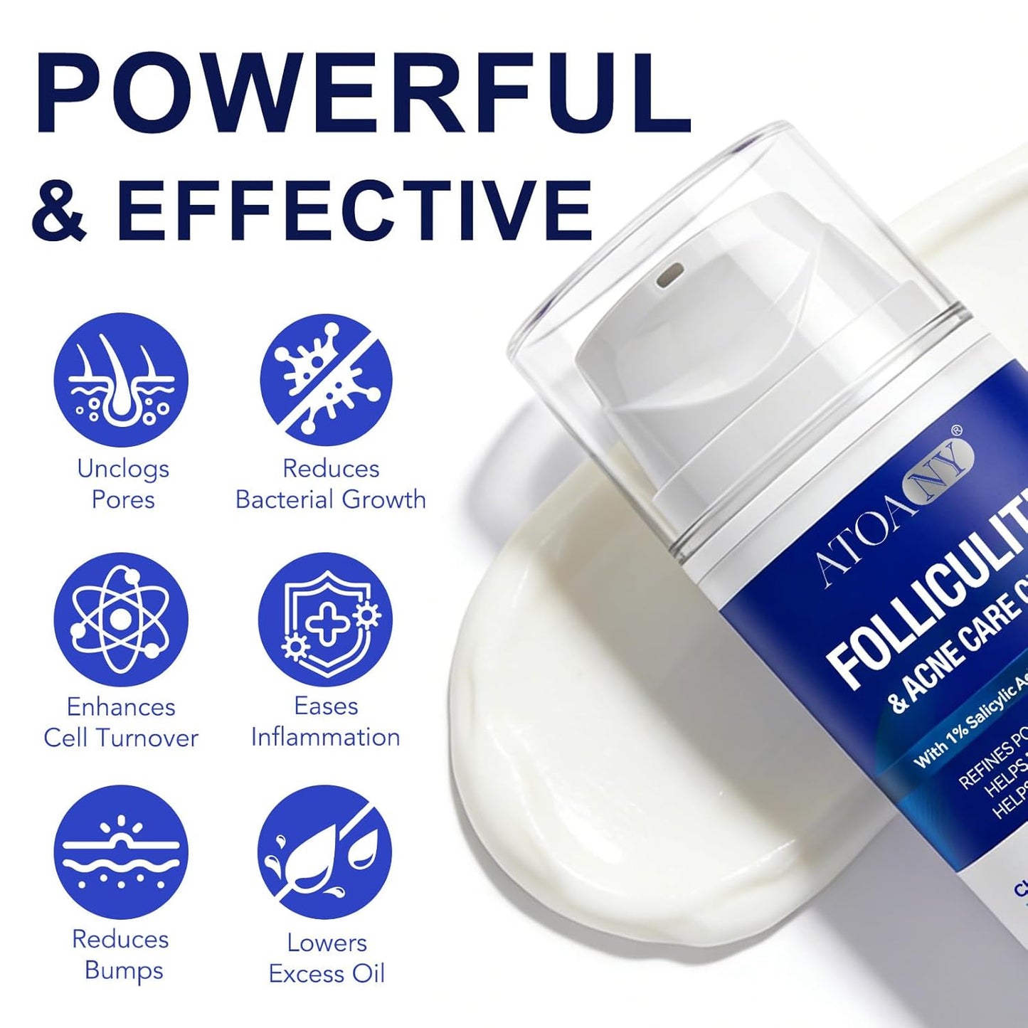 Folliculitis Treatment Cream - 1% Salicylic Acid for Scalp, Face & Body | Soothing Moisturizer for Sensitive Skin, 100g