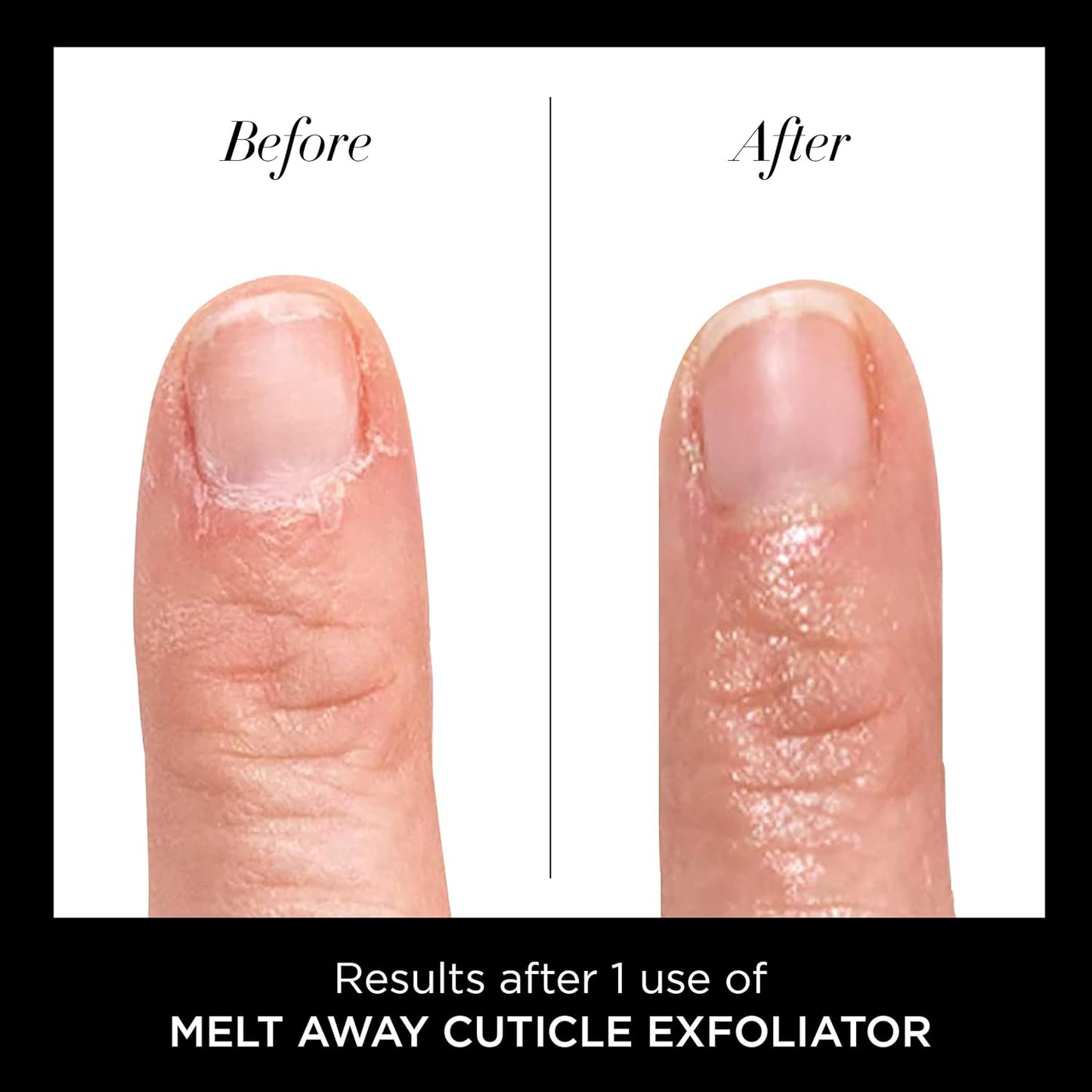 Cuticle Remover Liquid - Melt Away Cuticle Oil Exfoliator & Softener | Fast-Acting Pain-Free Formula - 0.4 Fl Oz