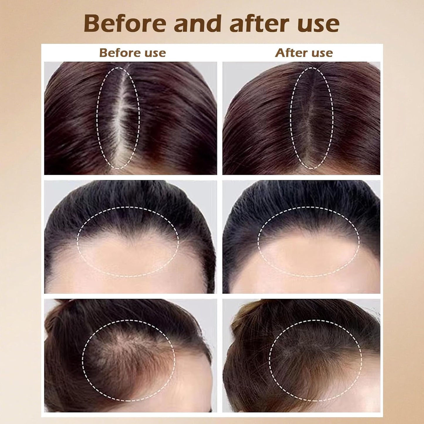 Invisible Hairline Powder - Volumizing Hair Fibers for Thinning Hair & Bald Spots | Instant Root Touch-Up, Water Resistant