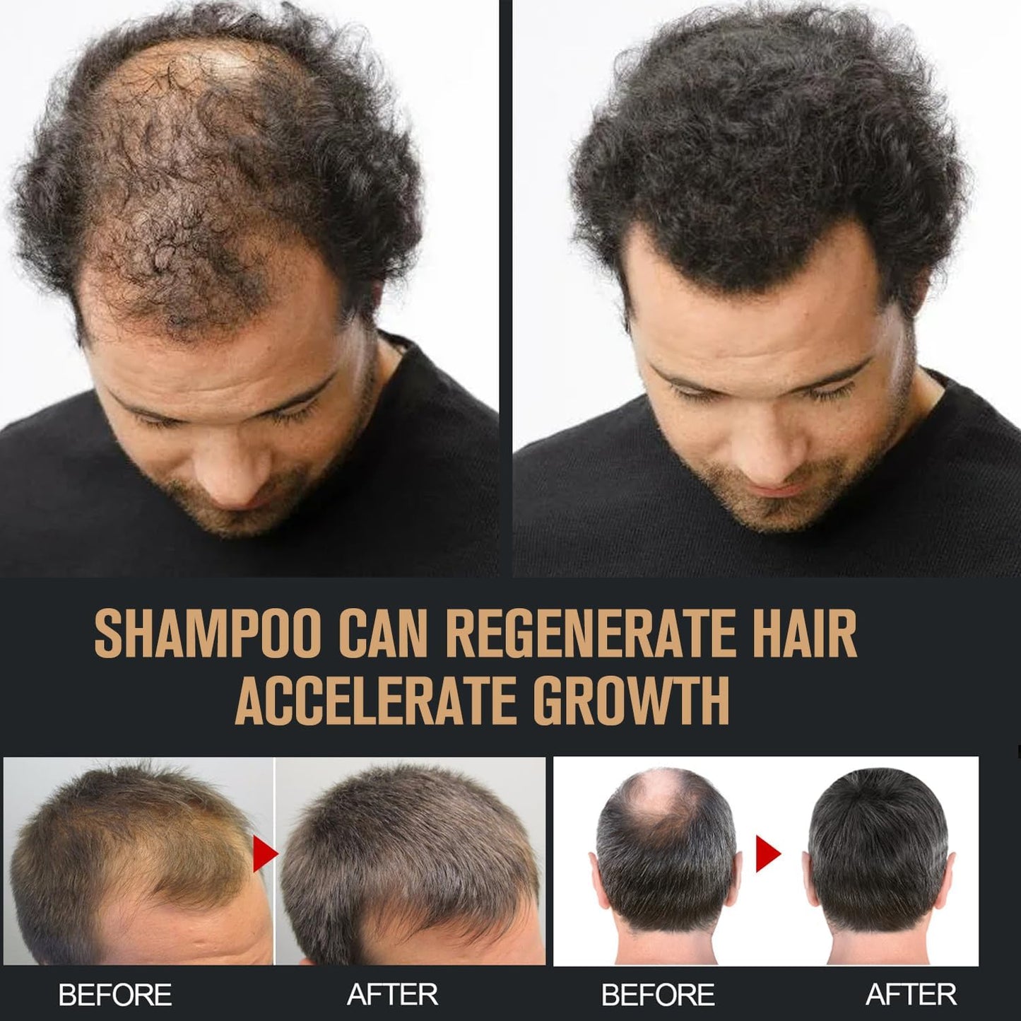 2 Pcs Root Activator Shampoo, Hair Growth Root Activator Shampoo, For Anti-Hair Loss, Natural Formula for Men and Women