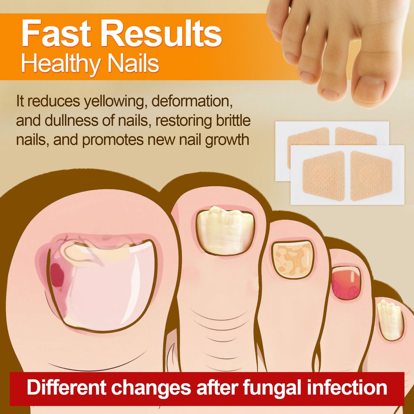 100pcs Nail Patches, 8-Hour Overnight Toenail Appearance Strips Extra Adhesive Daily Nail Nursing Stickers