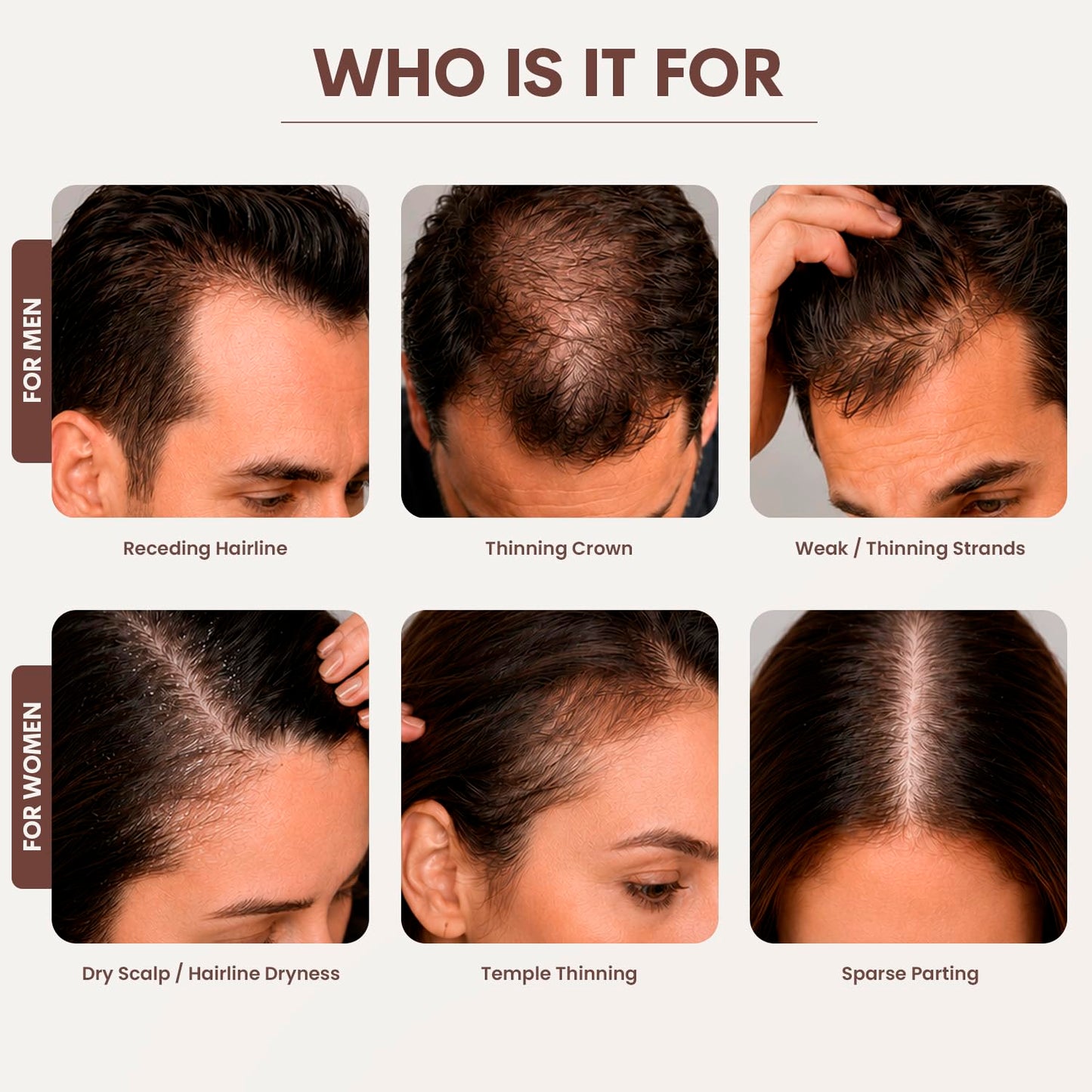 SØREN Micro Infusion Hair Renewal System - Saw Palmetto & Peptide Scalp Treatment Kit | Fuller, Thicker Hair | 3 Month Supply
