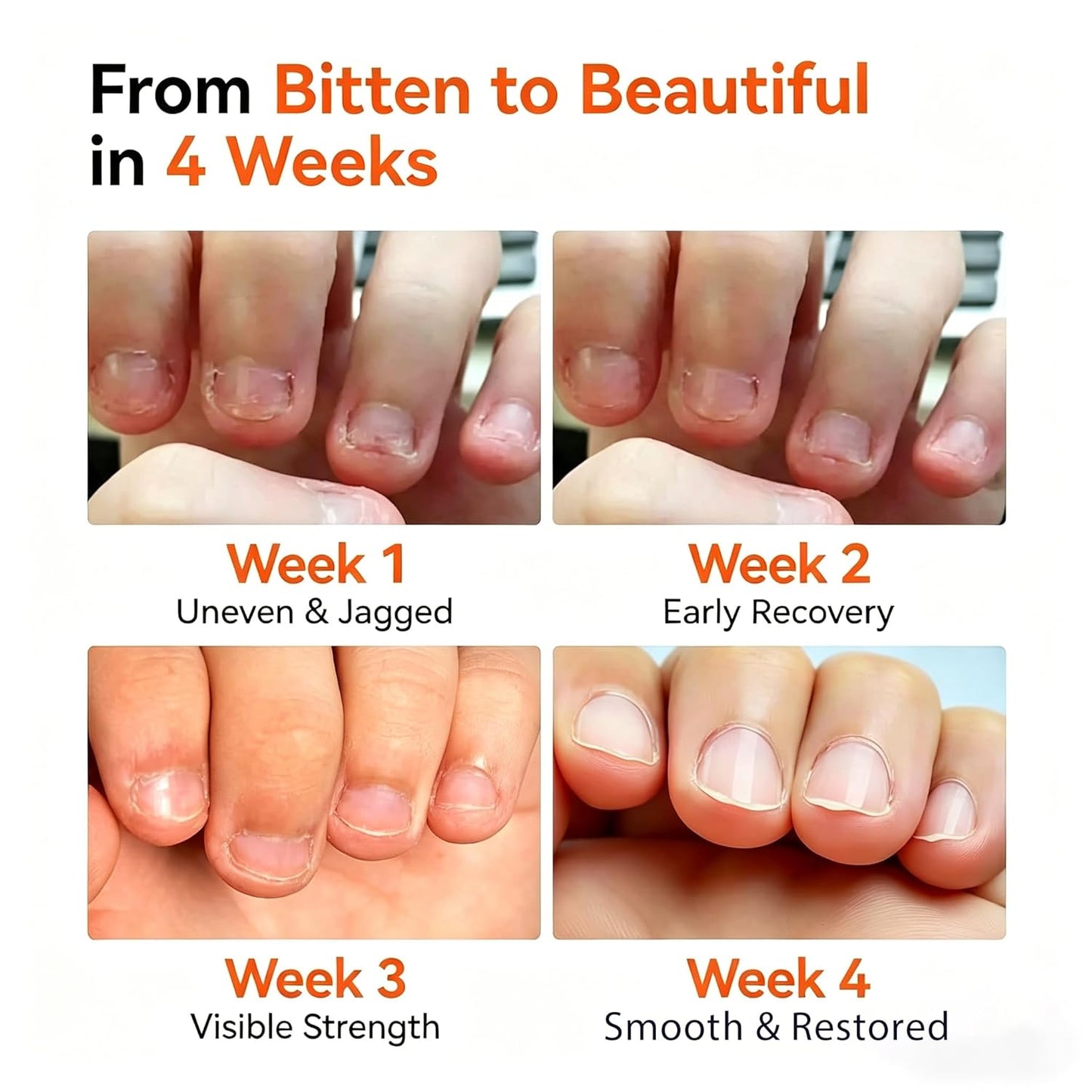 Modelones Nail Biting Prevention | Kids' Thumb Sucking Deterrent Bitter Nail Polish - 0.46 fl oz, Safe for Ages 1+