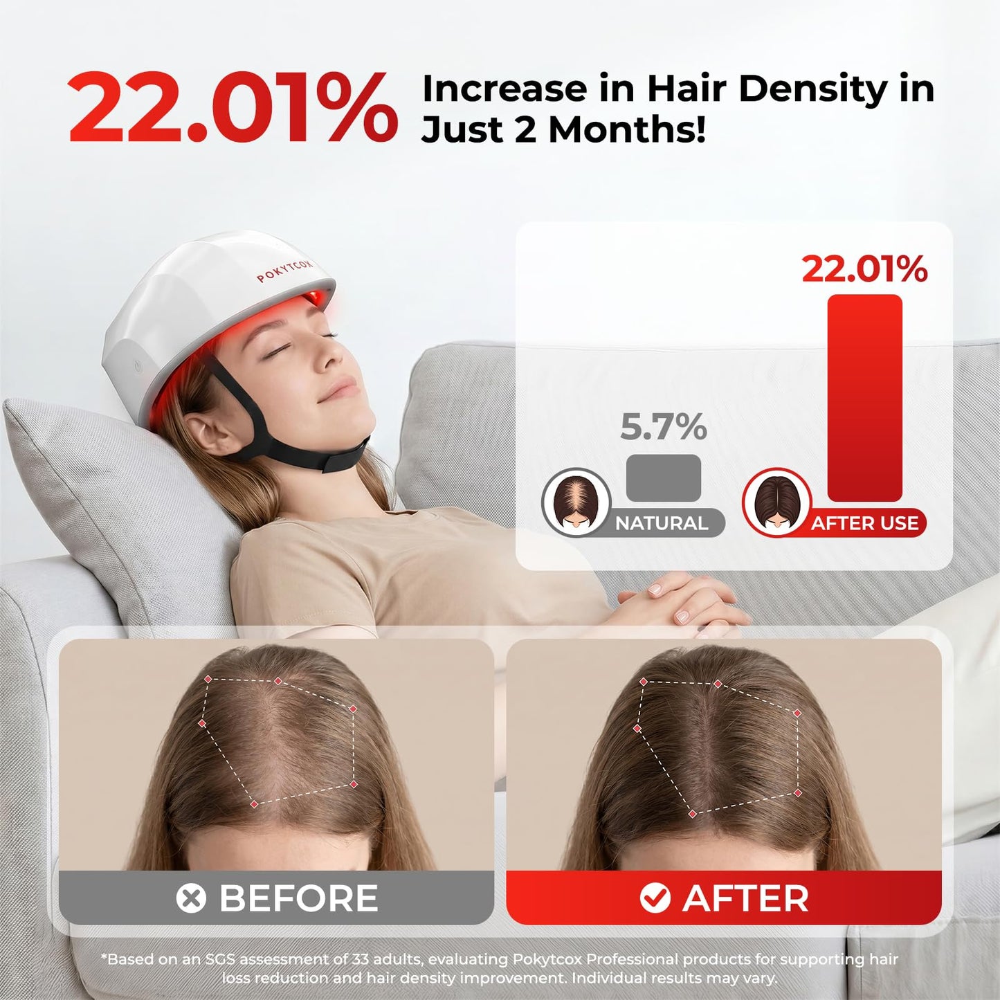 Laser Red Light Therapy for Hair Growth,FDA Cleared Hair Growth Device for Men & Women,650nm Low Level Laser Therapy for Thinning Hair & Alopecia, 200 Lasers Full Scalp Coverage Home Use(KCA451-200S)