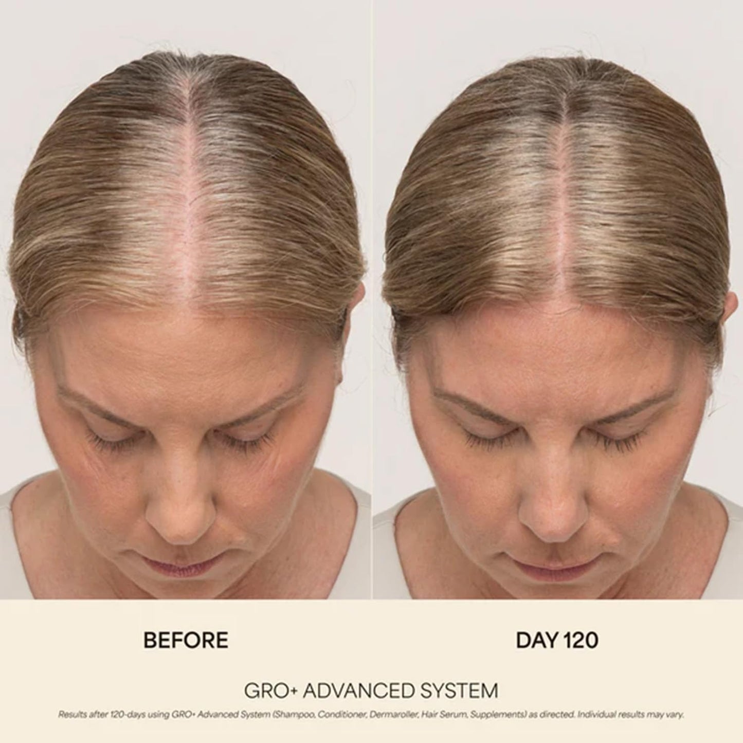 VEGAMOUR GRO+ Hair Serum - Boost Hair Density & Reduce Shedding | Vegan, Fragrance-Free, For Thinning Hair