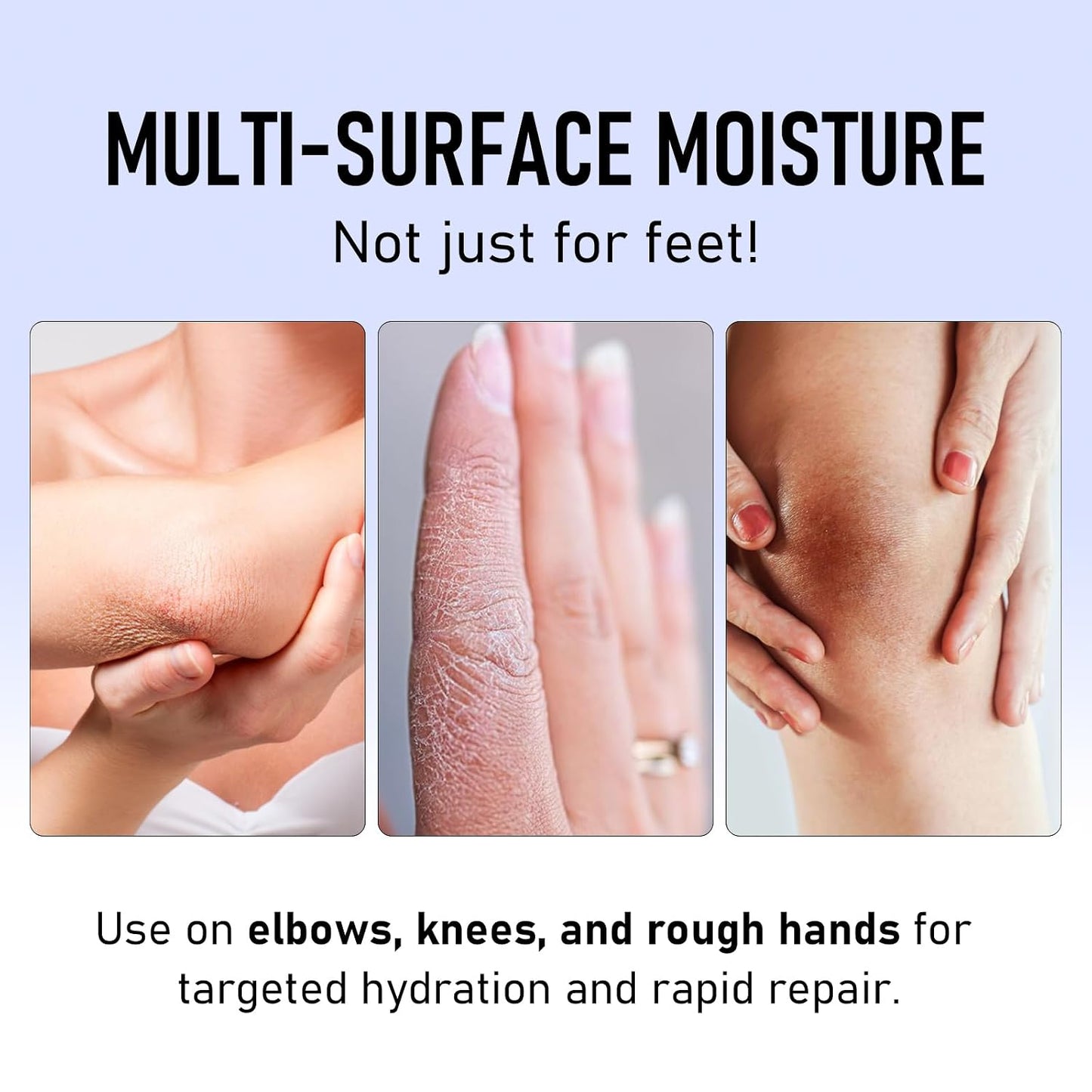 Crack Feet Prevention Stick - Moisturizing Foot & Hand Balm for Softening Dead Skin | Nourishing Anti-Cracking Cream