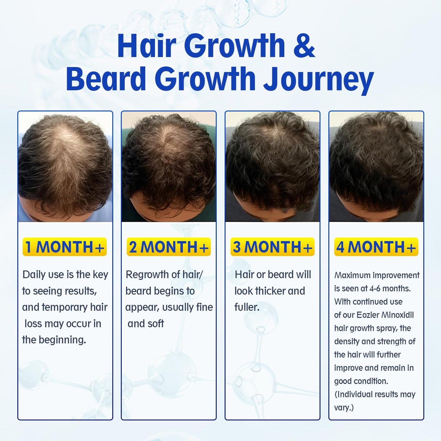 Minoxidil Hair Regrowth Treatment - 5% Solution with Biotin for Thinning Hair | 4 FL OZ/120mL