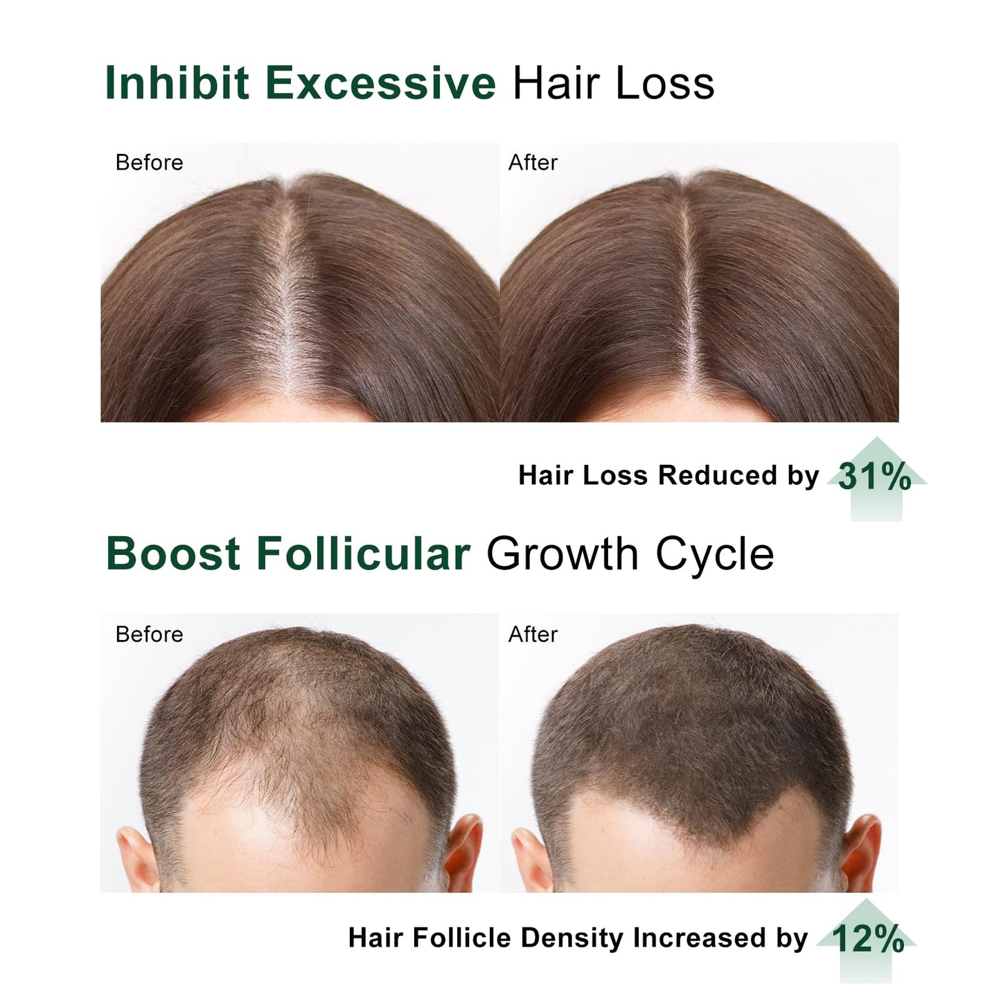 Hair Growth Serum, Rosemary Oil for Hair Growth, Thinning Hair & Hair Density Serum with Flow Controlled Massage Applicator, Peptides, Niacinamide, Caffeine, Scalp Serum for Reduced Hair Fall 60 ML