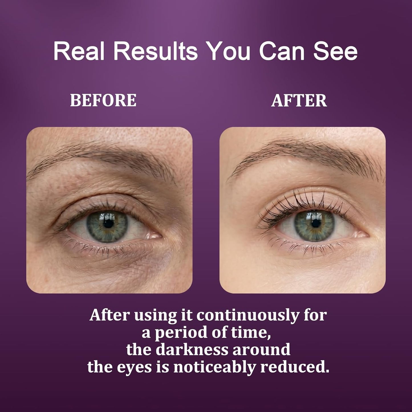 Calcium Dark Spot Eye Cream - Anti-Aging Formula for Dark Circles & Sagging Skin | 2 Pack