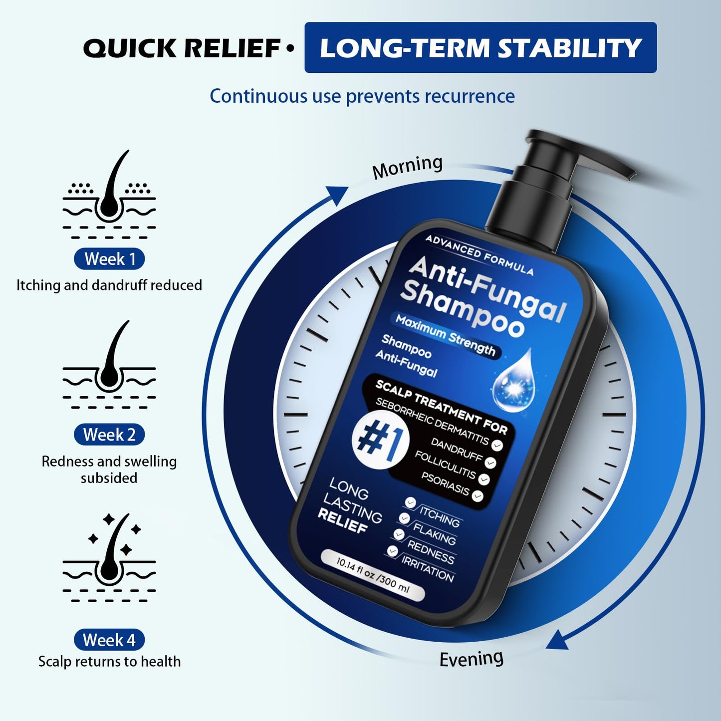 Antifungal Psoriasis Shampoo for Seborrheic Dermatitis, Folliculitis & Scalp Psoriasis, Anti-Dandruff Shampoo for Men & Women, Relieves Scalp Itching, Dryness, Sulfate & Paraben-Free, 10.1 Fl Oz-Fresh