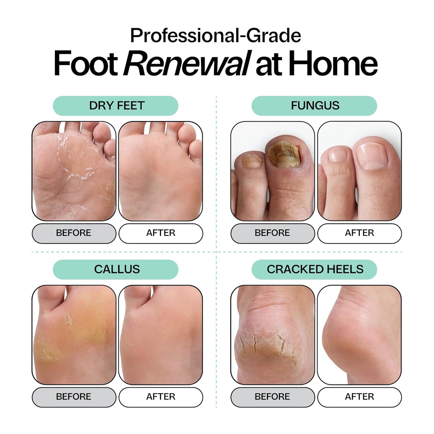 Tea Tree Oil Foot Soak - Epsom Salt for Toenail Repair & Odor Elimination | 16 oz, Made in USA