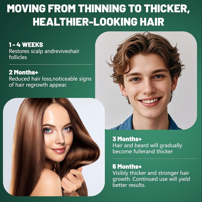 Minoxidil Hair Growth Treatment for Men & Women - Biotin & Rosemary Beard Growth Serum | Strengthens Roots, Repairs Thinning Hair