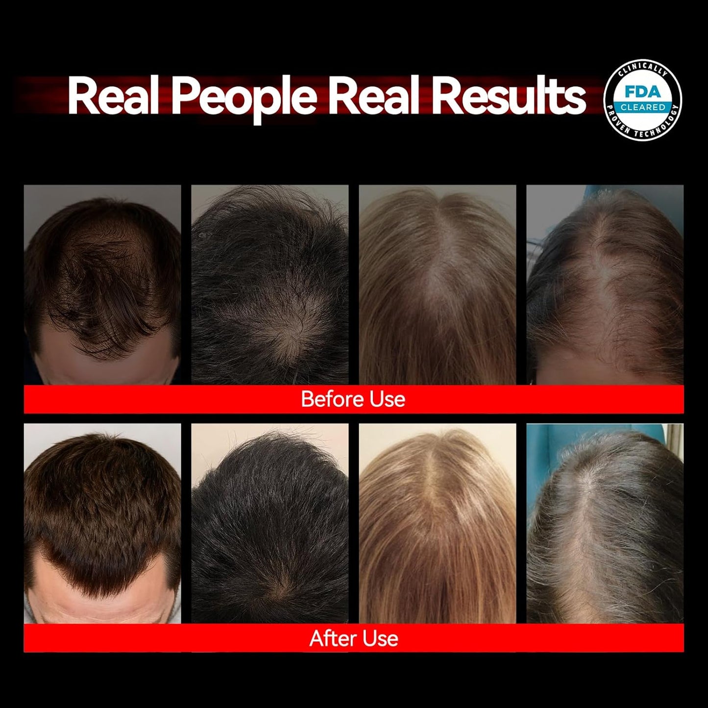 Laser Cap Hair Growth Device - FDA Cleared Red Light Therapy for Thinning Hair | Effective Alopecia Treatment for Men & Women