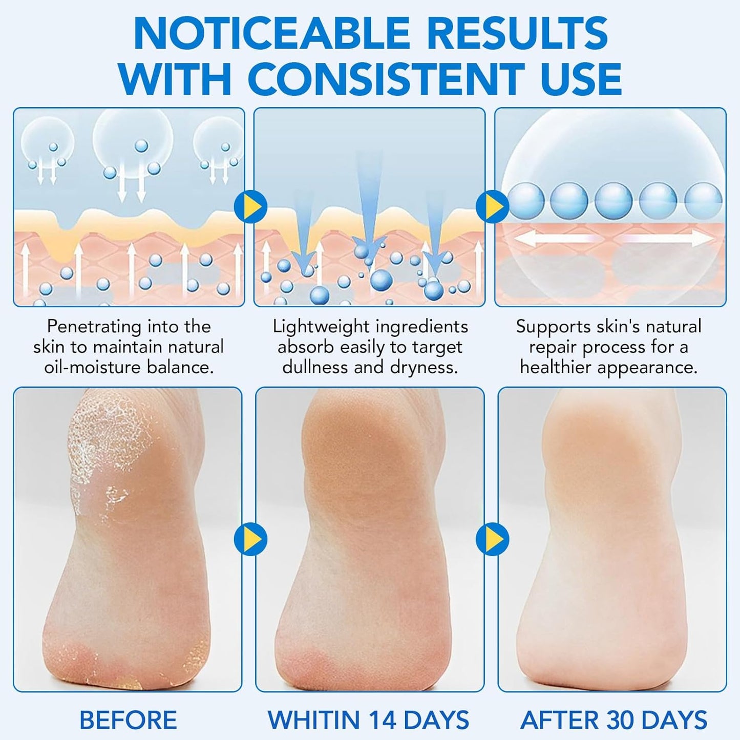 Urea Foot Cream Stick - 60% Urea & 2% Salicylic Acid | Moisturizing Foot Care for Dry Cracked Skin, 1.41 oz