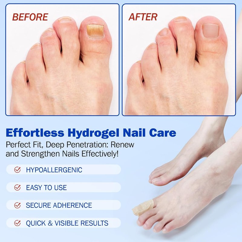 Fungal Nail Care Patches - Hydrogel Strips for Damaged Nails | 21 PCS, 8-Hour Nourishing Gel