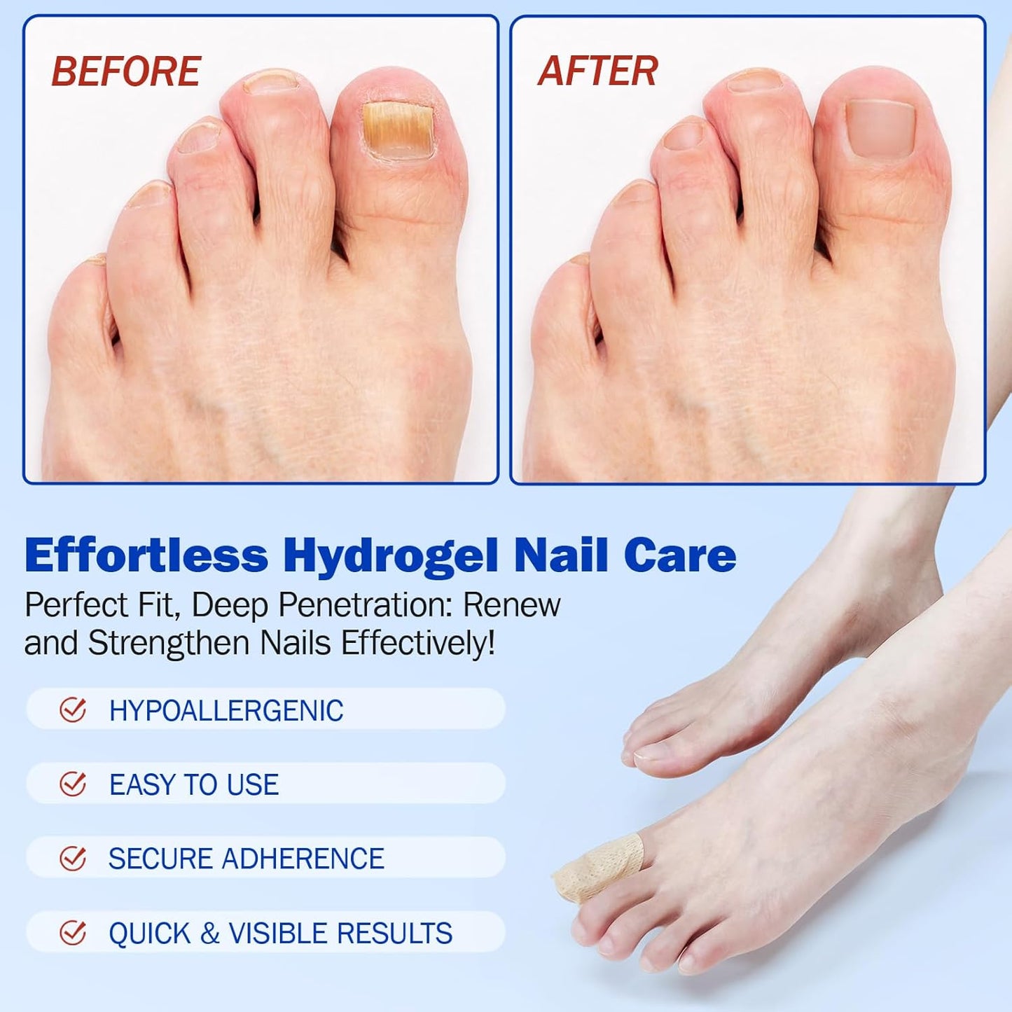 Toenail Treatment Patches - Extra Strength Hydrogel Repair for Damaged, Thick & Brittle Toenails | 42PCS Set