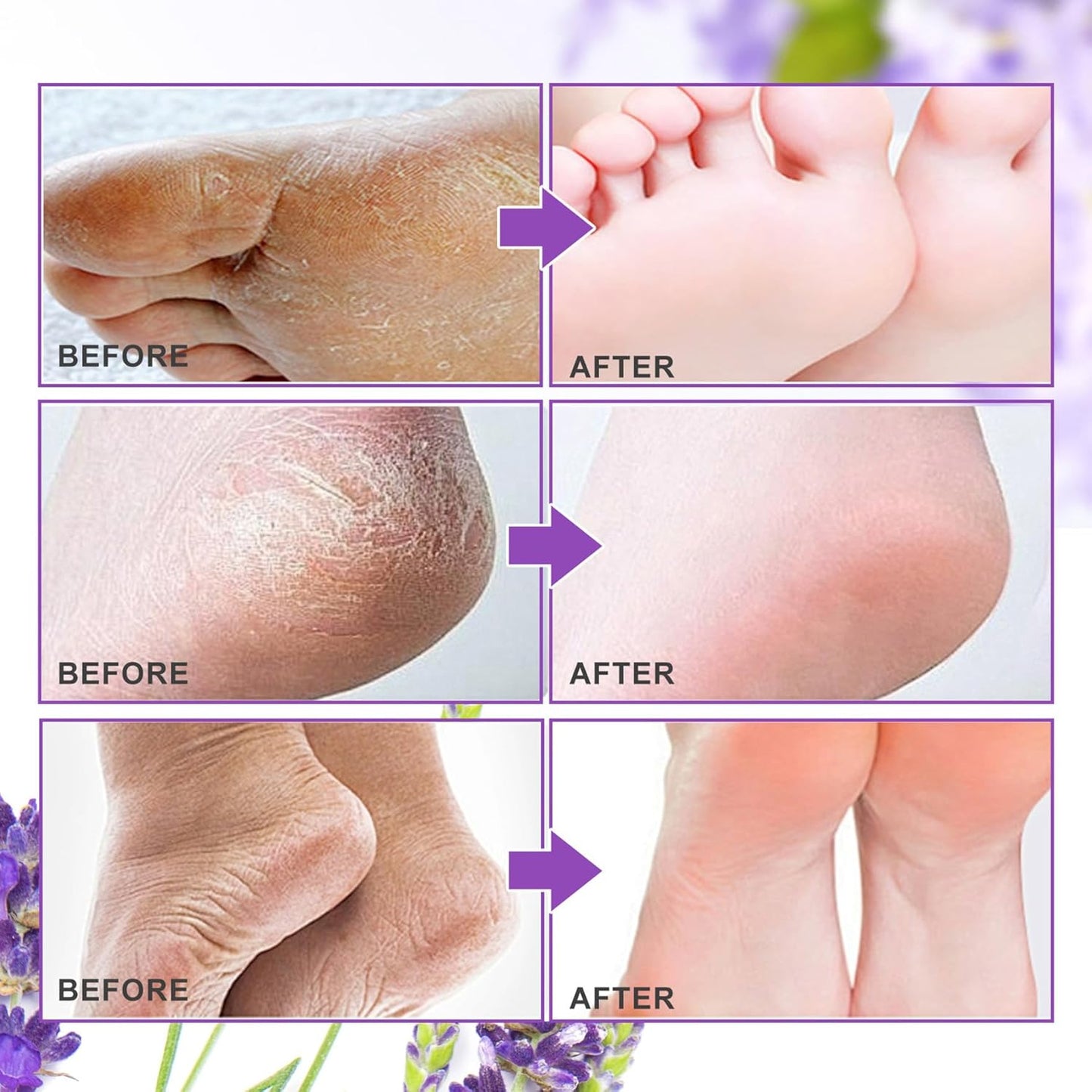 Aliver Foot Peel Mask - Exfoliating Callus Remover for Baby Soft Feet | 3 Pack, Lavender Scent