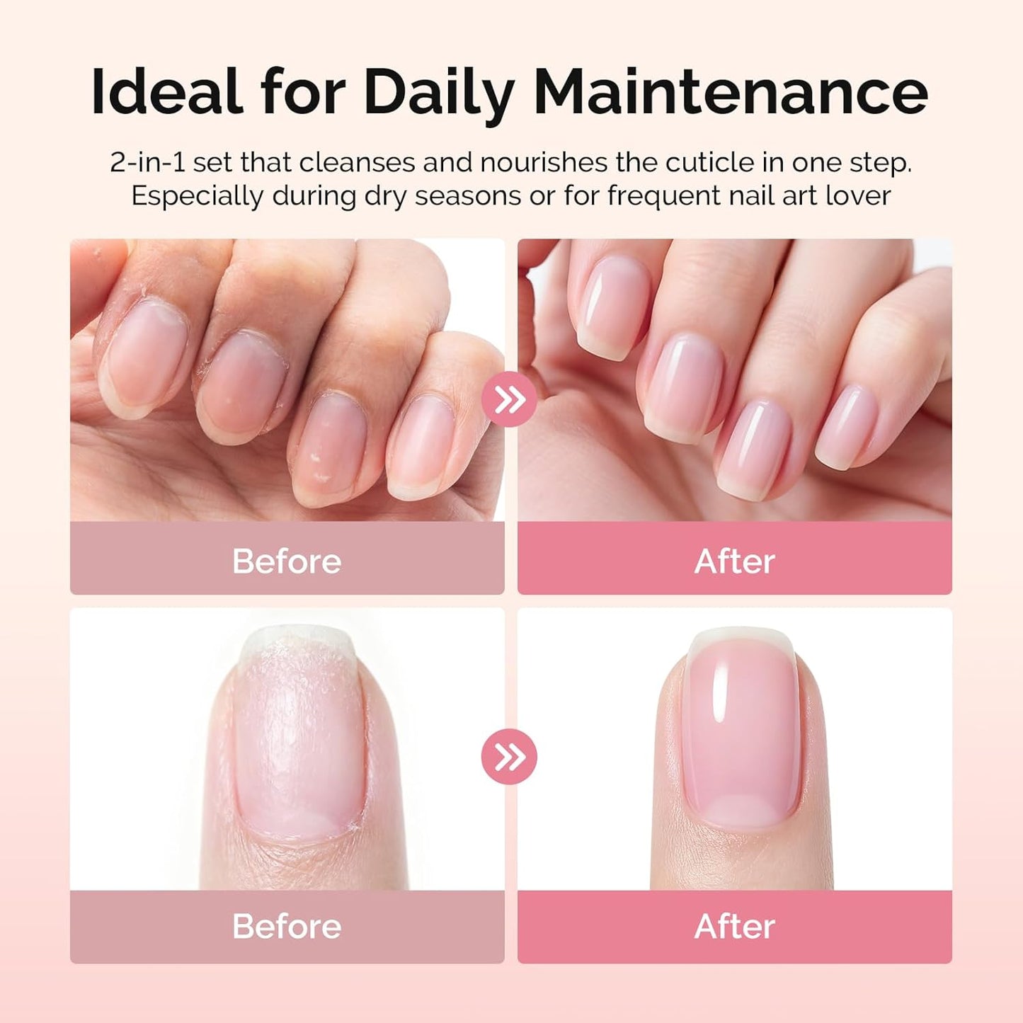 MelodySusie Cuticle Remover Kit - 60g Cream, 15ml Oil, Nipper & File | Essential Nail Care Set