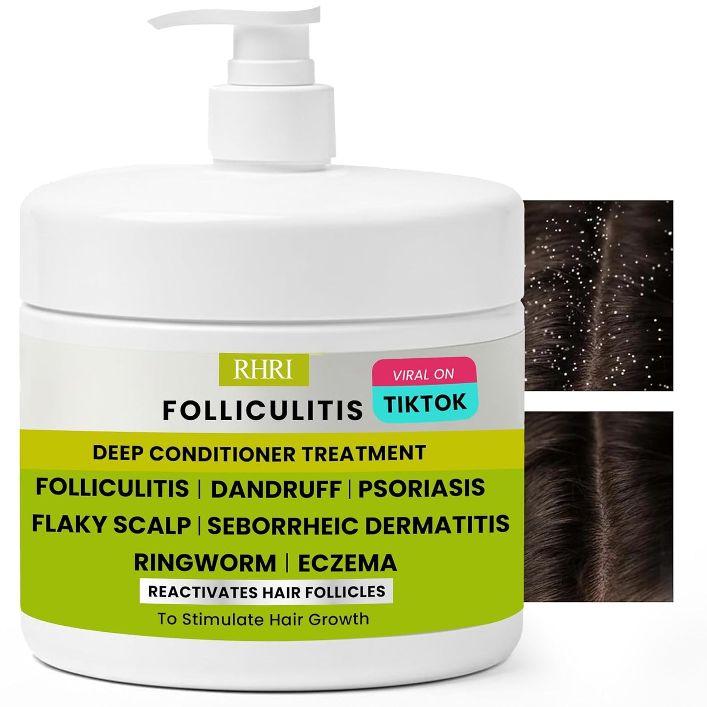 Deep Conditioner for Folliculitis - Effective Scalp Treatment for Seborrheic Dermatitis & Dandruff | Nourishes Oily Hair & Promotes Hydration