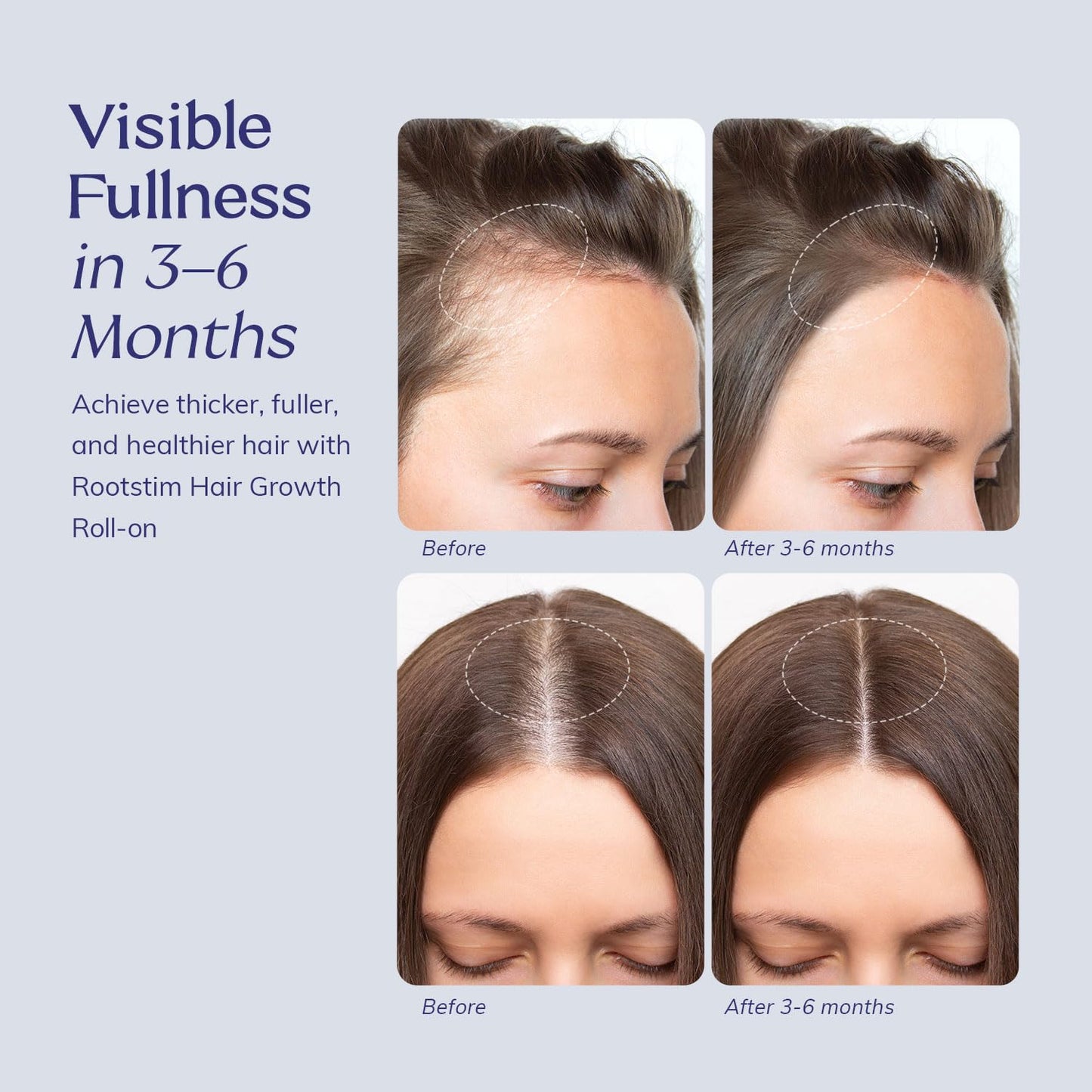 Hair Growth Serum Roll-On | Rosemary, Caffeine & Biotin Formula for Fuller-Looking Hair - 1.08 Fl Oz
