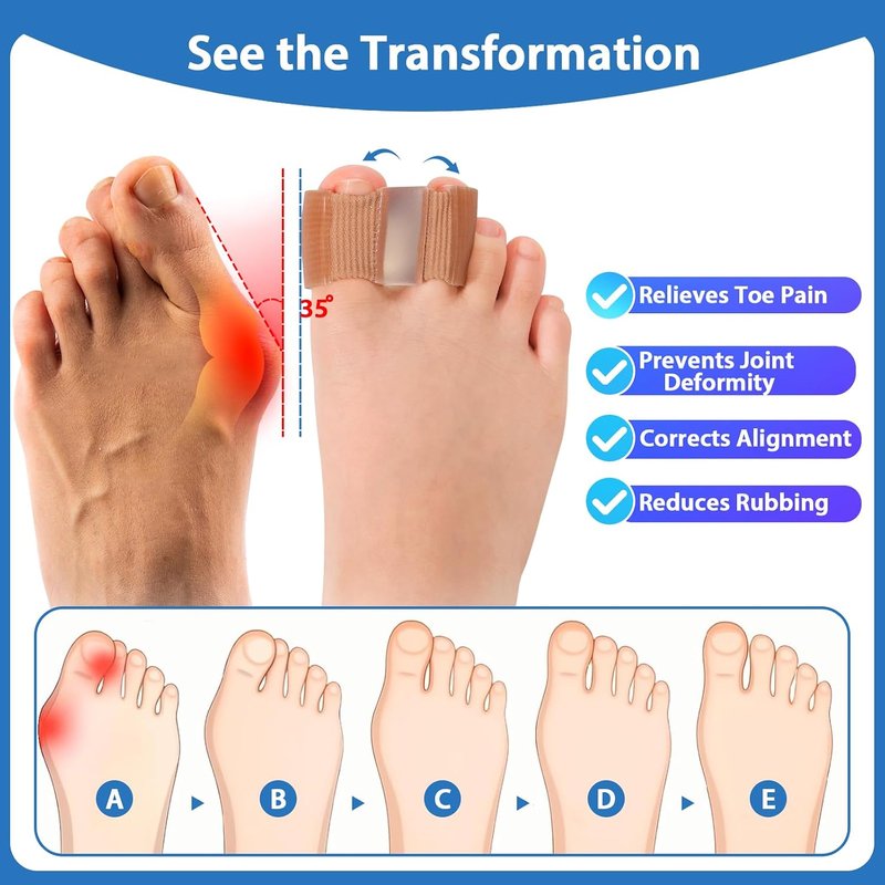 Bunion Toe Separators - 3-Point Gel Spacers for Overlapping Toes | 4 Pack, Large Size