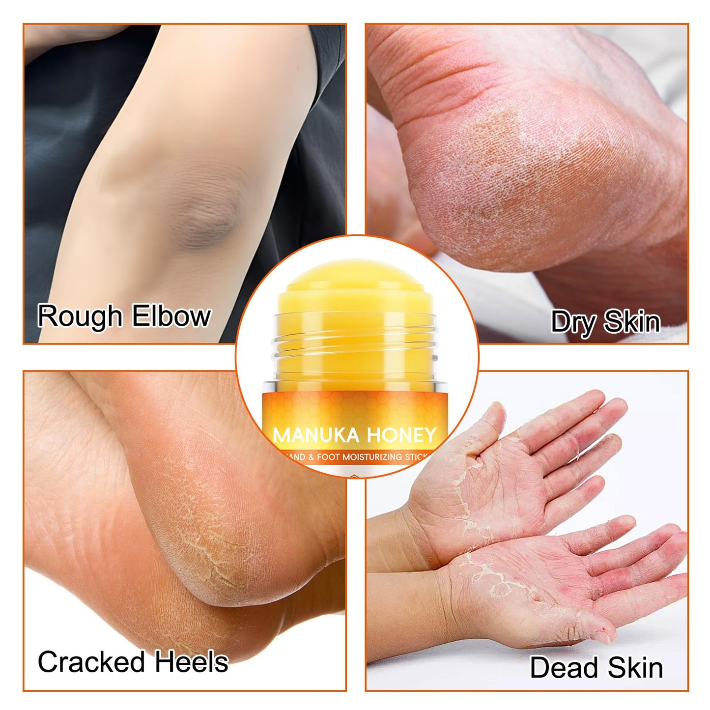 chenyayun 2 Pack Manuka Honey Cracked Heel Treatment Balm Stick, Dry & Cracked Foot Repair for Intensively & Deeply Moisturizing & Hydrating, Soothing, with Shea Butter, Chamomile|1.41 Oz/40 G