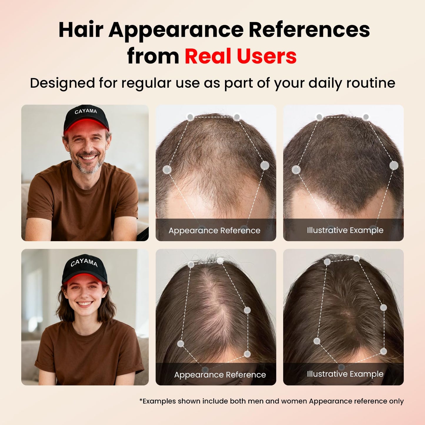 CAYAMA Red Light Hair Growth Cap, 528 Light Emitters, Full Scalp Coverage, Stable Corded Power, Consistent At-Home Sessions for Men & Women