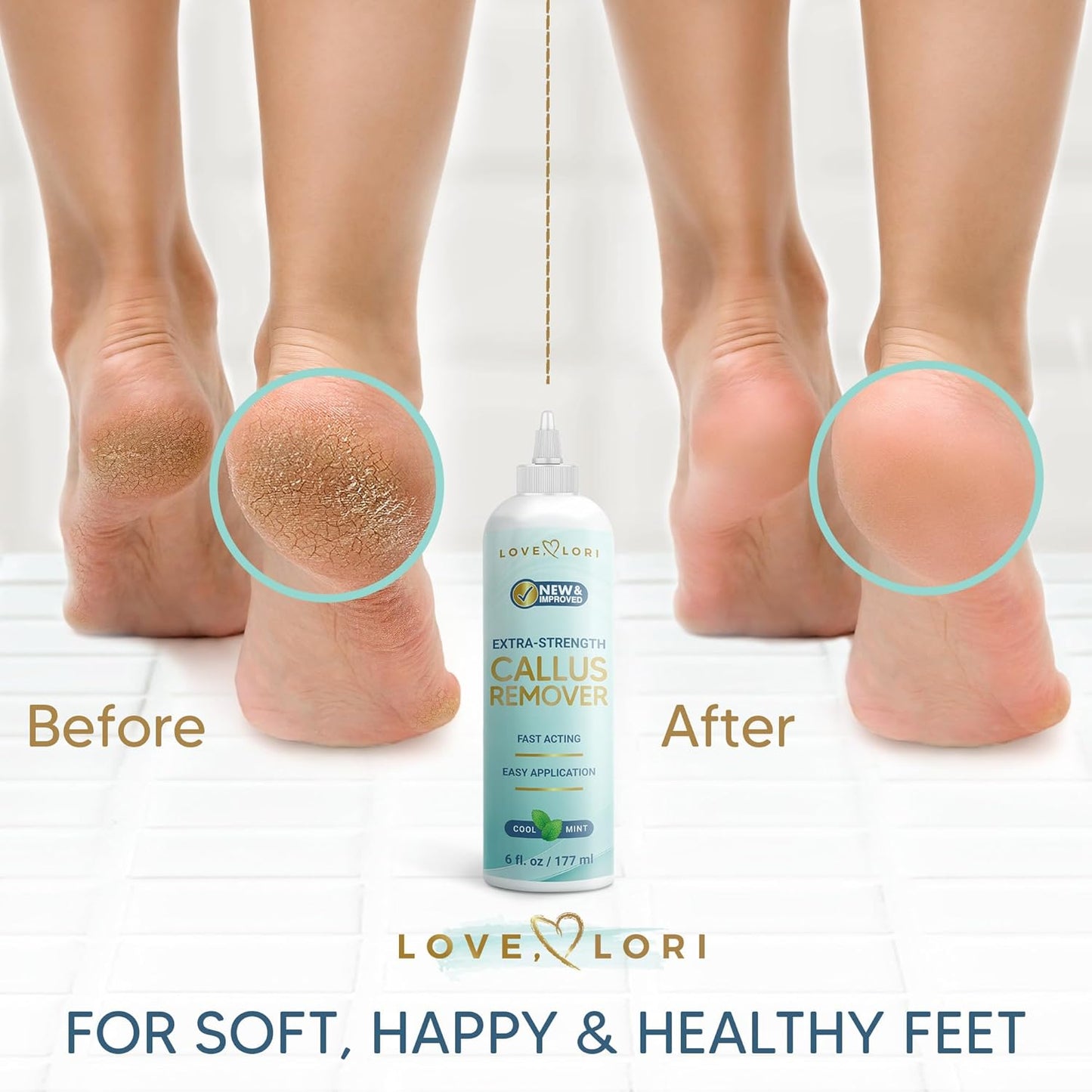 Callus Remover Gel for Feet - Extra Strength Foot Care Scrubber | 6oz Pedicure Tool