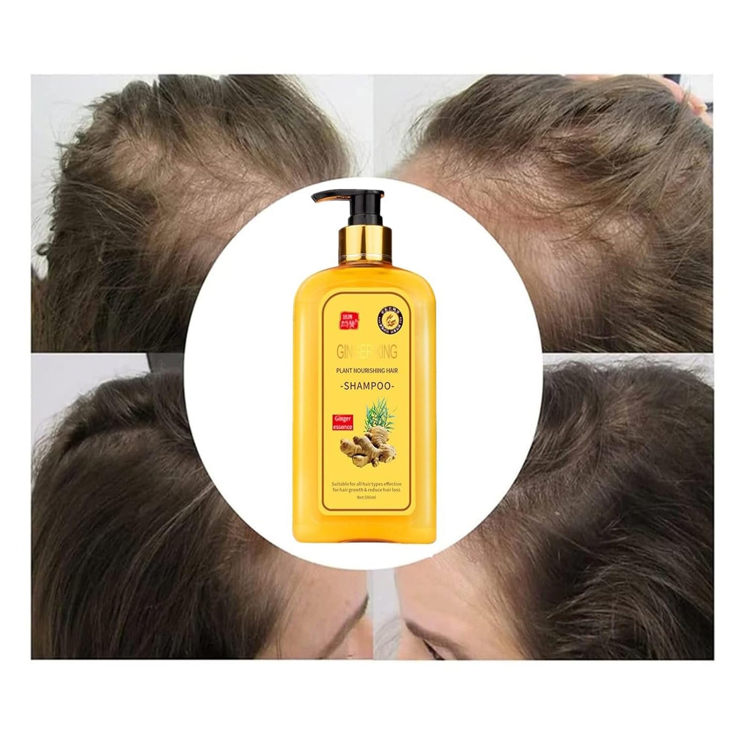Ginger Hair Regrowth Shampoo - Instant Anti-Hair Loss Formula | 16.91 FL. oz (500ML)