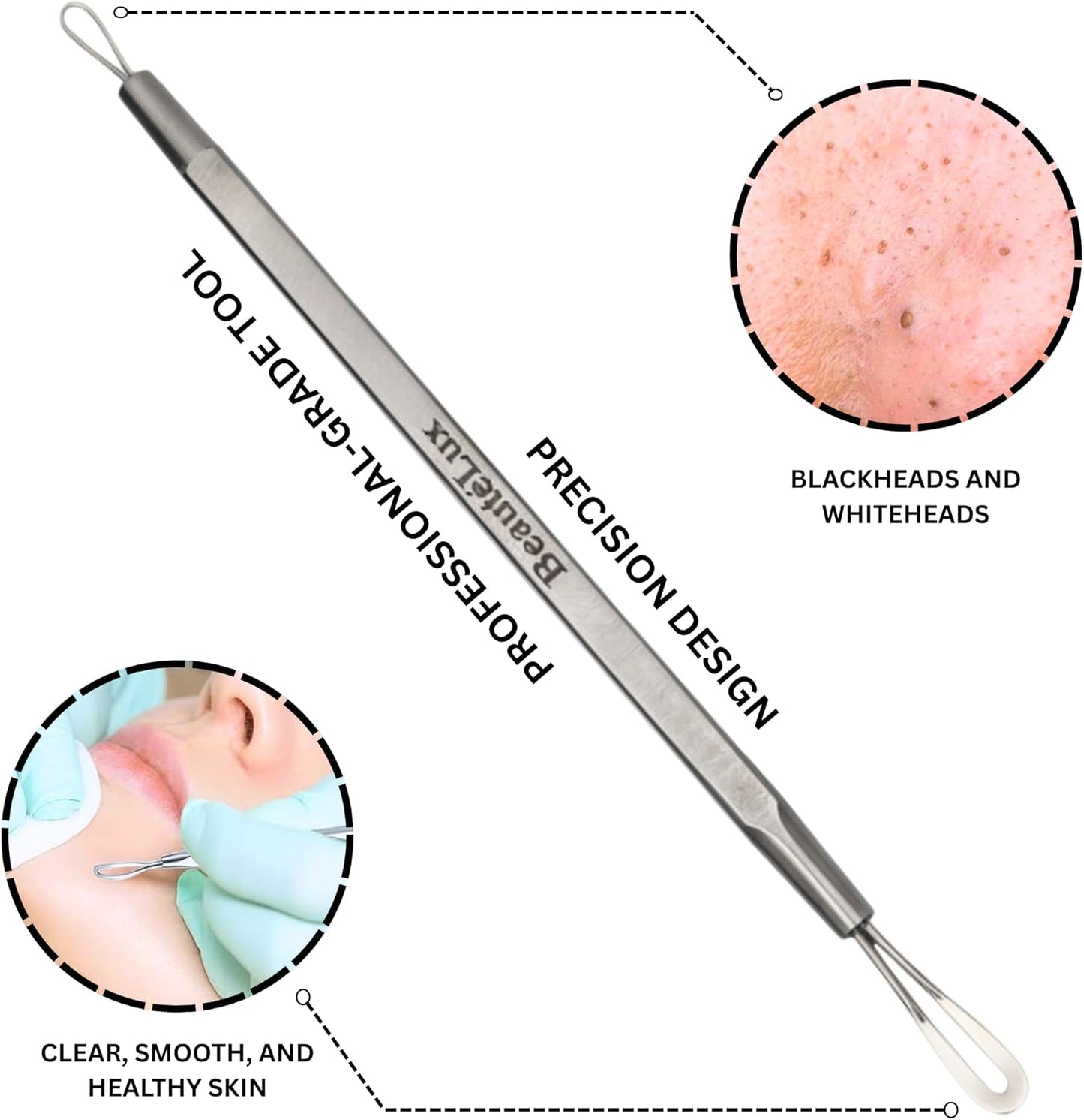 Blackhead Removal Tool - 2-in-1 Stainless Steel Acne Extractor | Dual-Loop Pimple Remover with Grey Leather Pouch