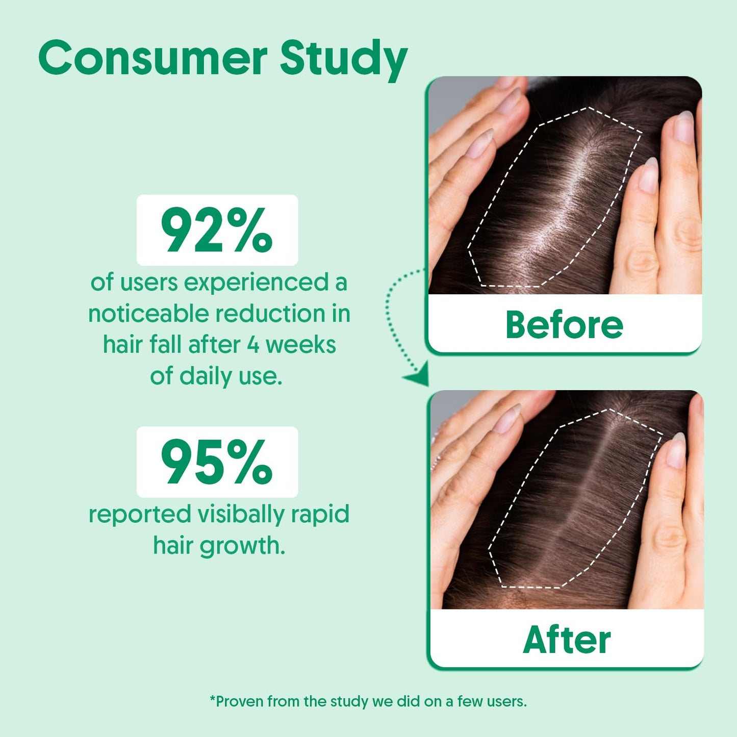 Aravi Organic Rosemary & Biotin Hair Growth Serum - For Hair Growth, Strengthens Hair, and Nourishes Scalp- 1 Fl Oz / 30 ml