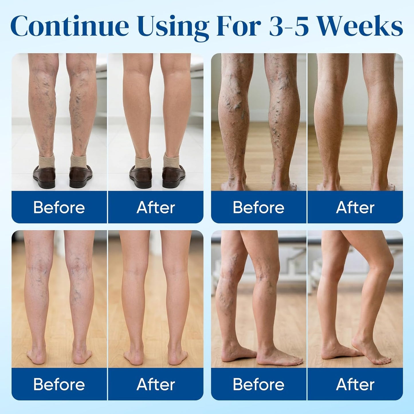 Vein Target Microdarts Patch - Natural Varicose Vein Treatment for Legs | 2 Pack